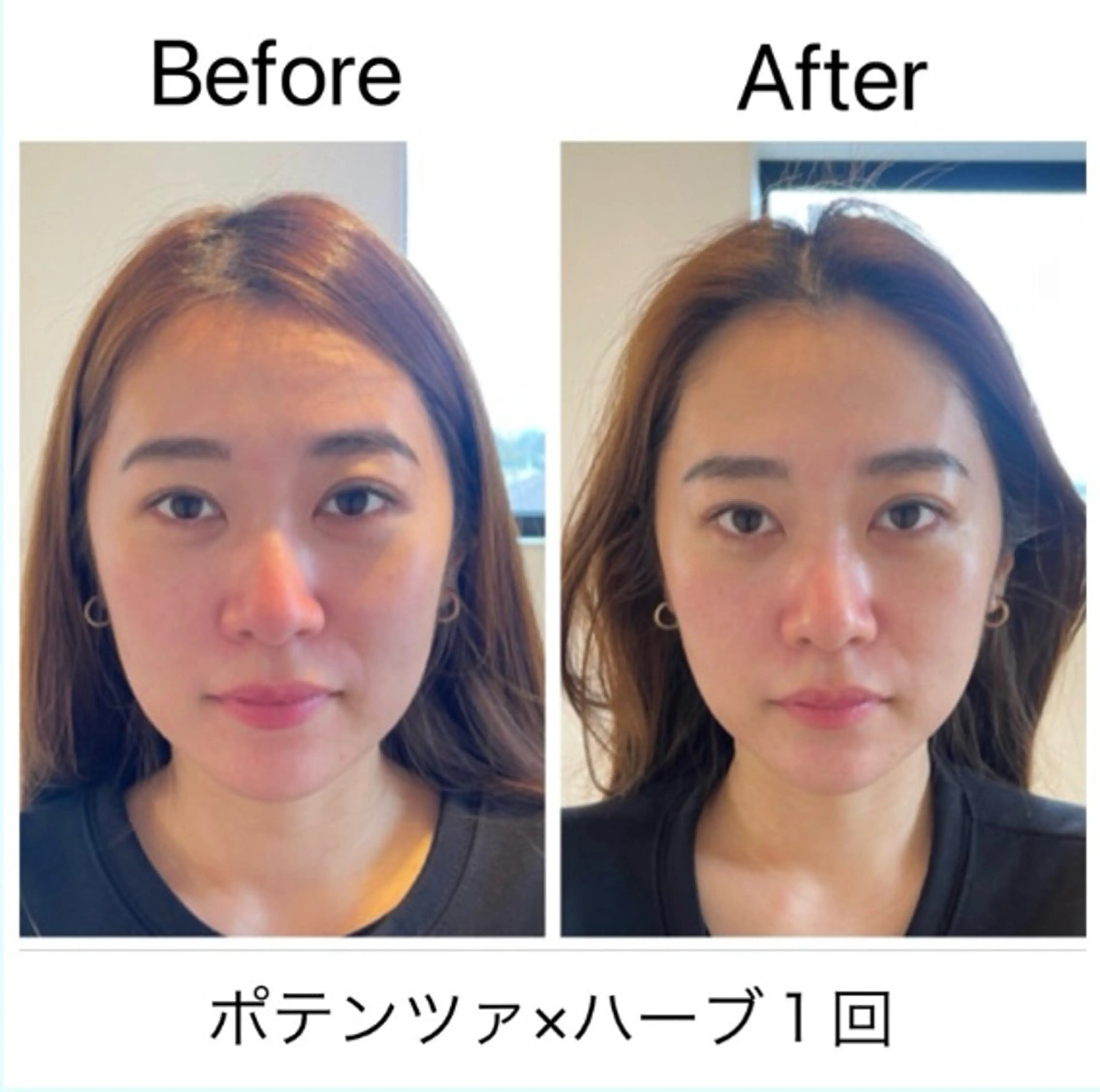 エステ 肌管理 OGUMOのエステ・リラクイメージ