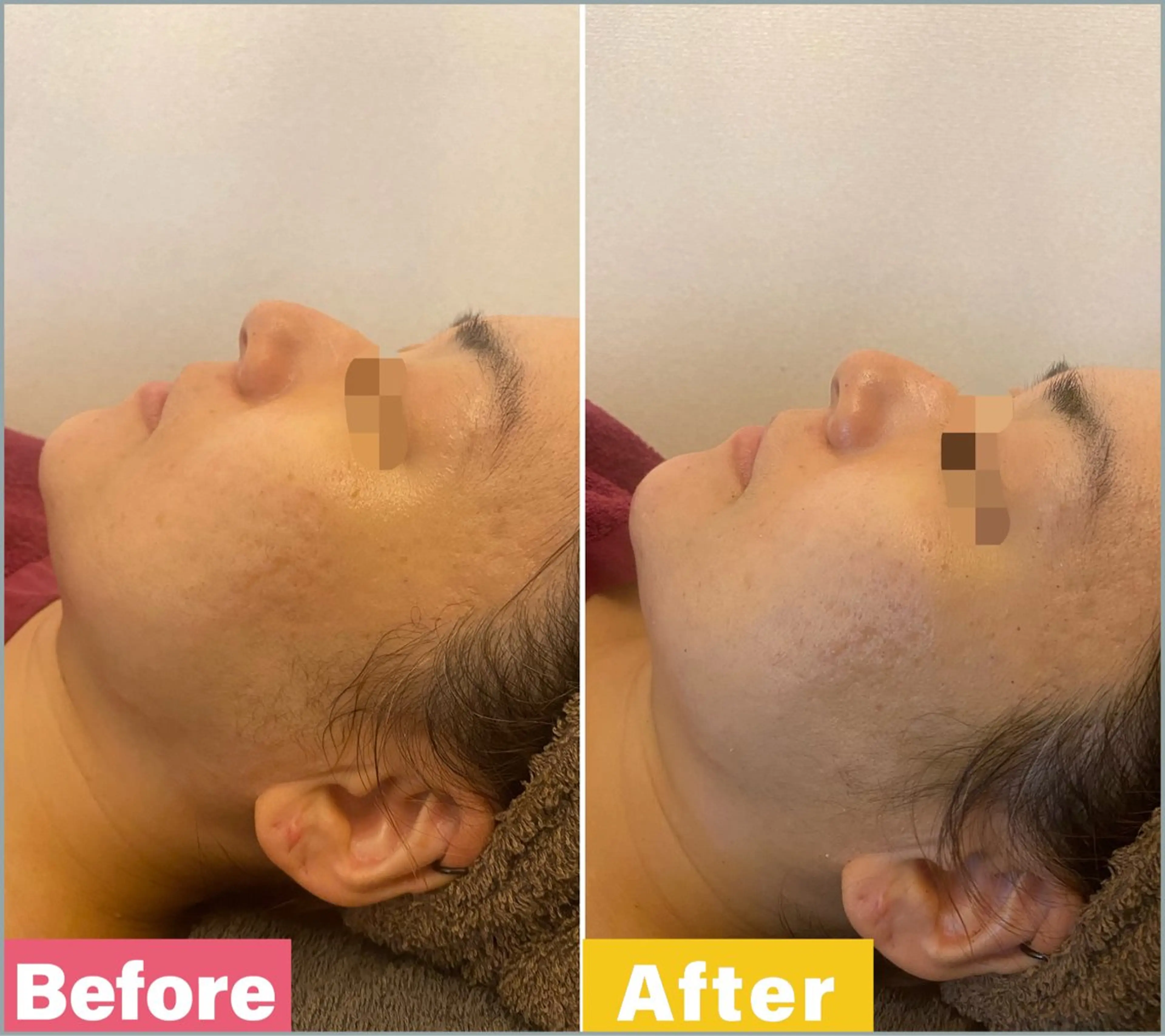 エステ Lapin lunaireのエステ・リラクイメージ