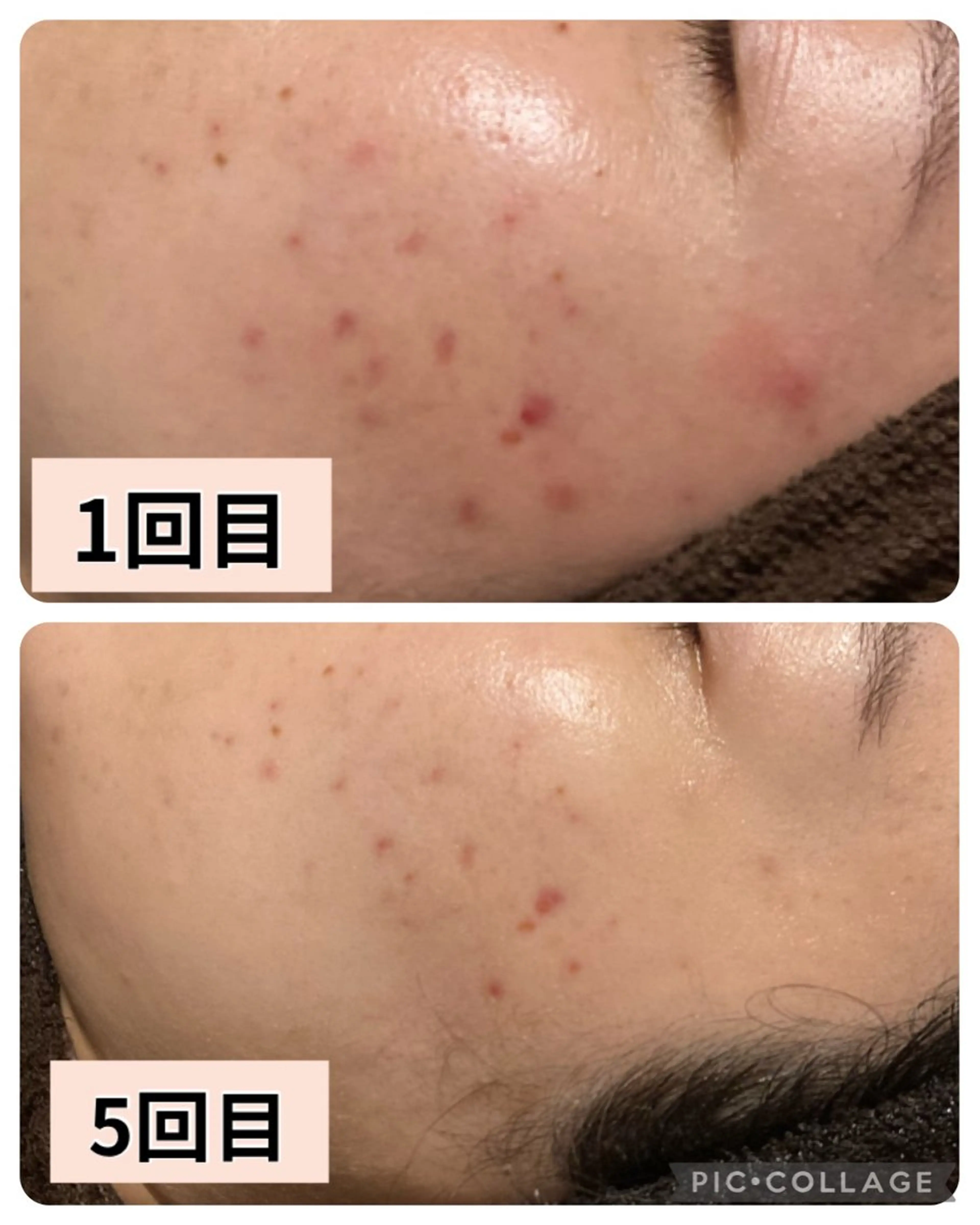 ハーブピーリング 専門／今榮麻美のエステ・リラクイメージ