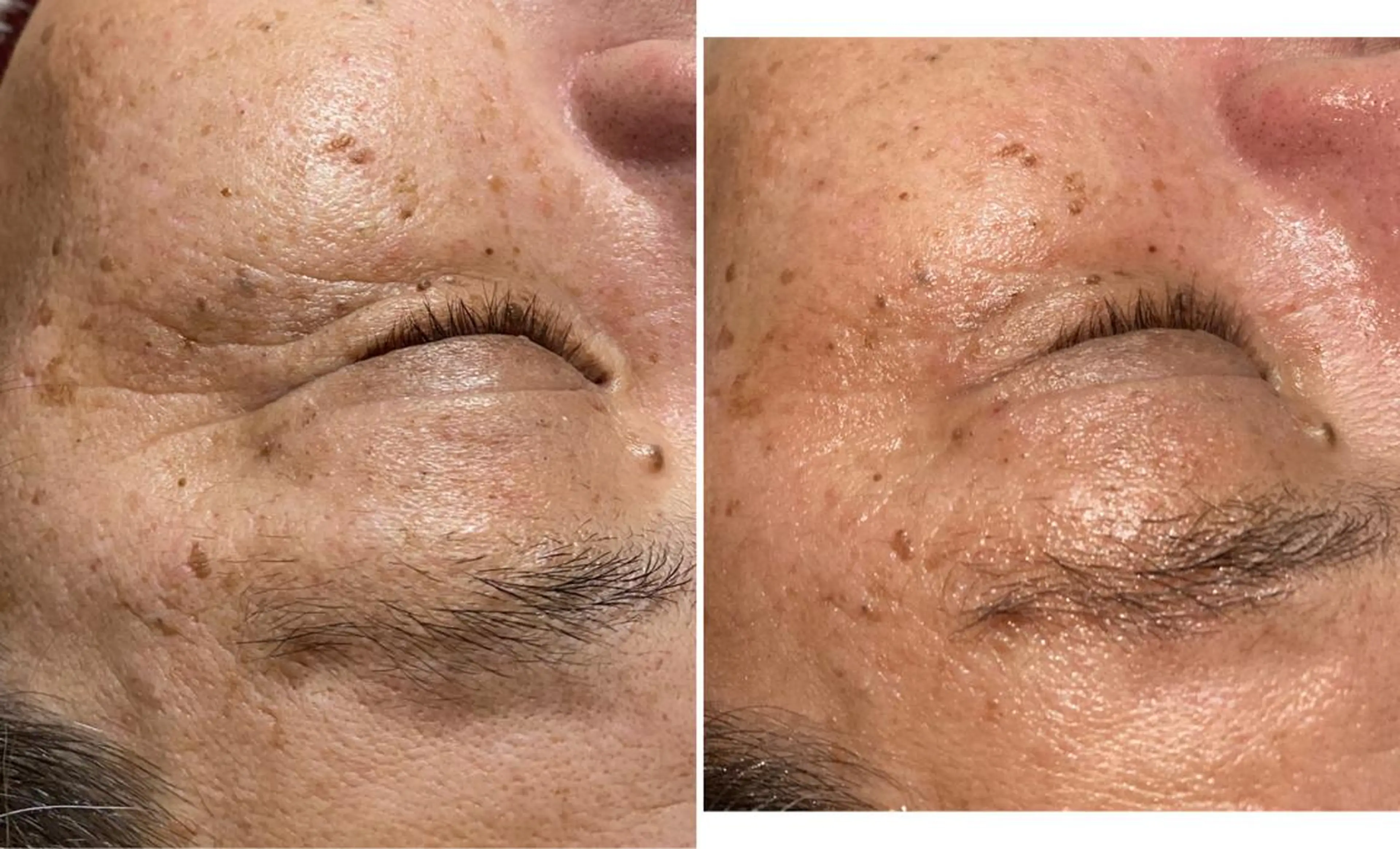 ピーリング専門サロン Spicaのエステ・リラクイメージ