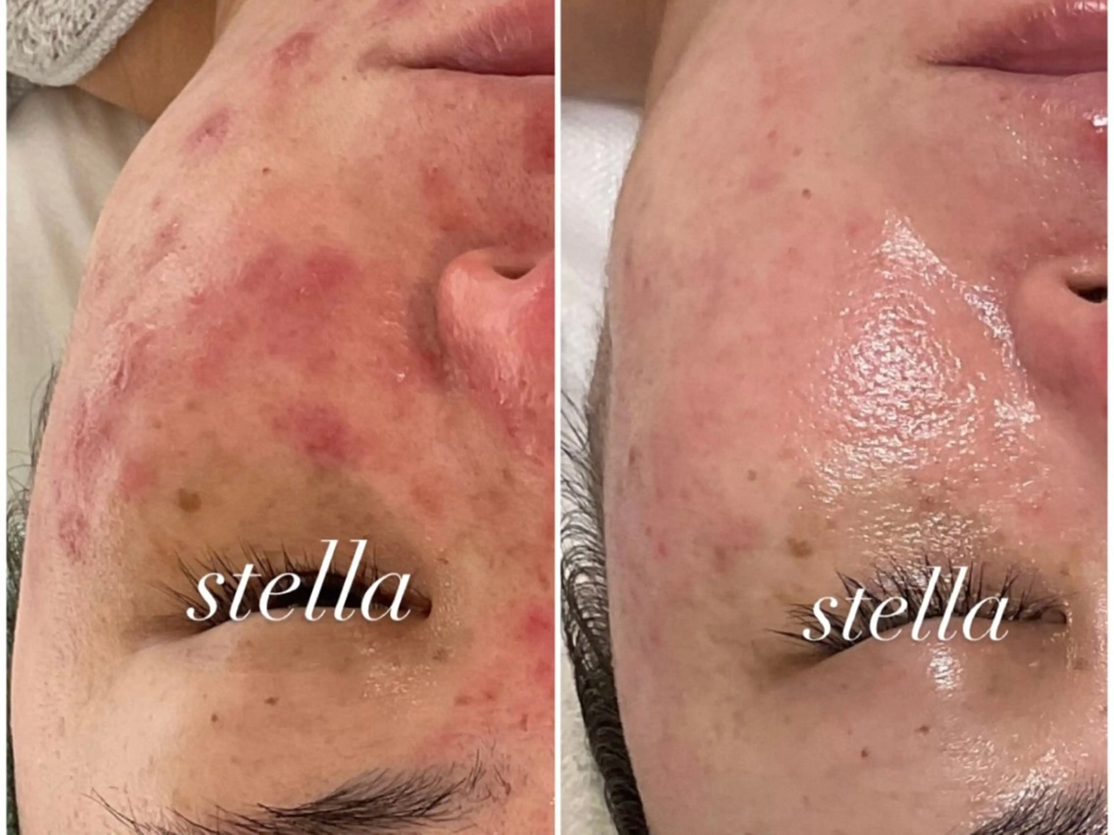 Stella .のエステ・リラクイメージ