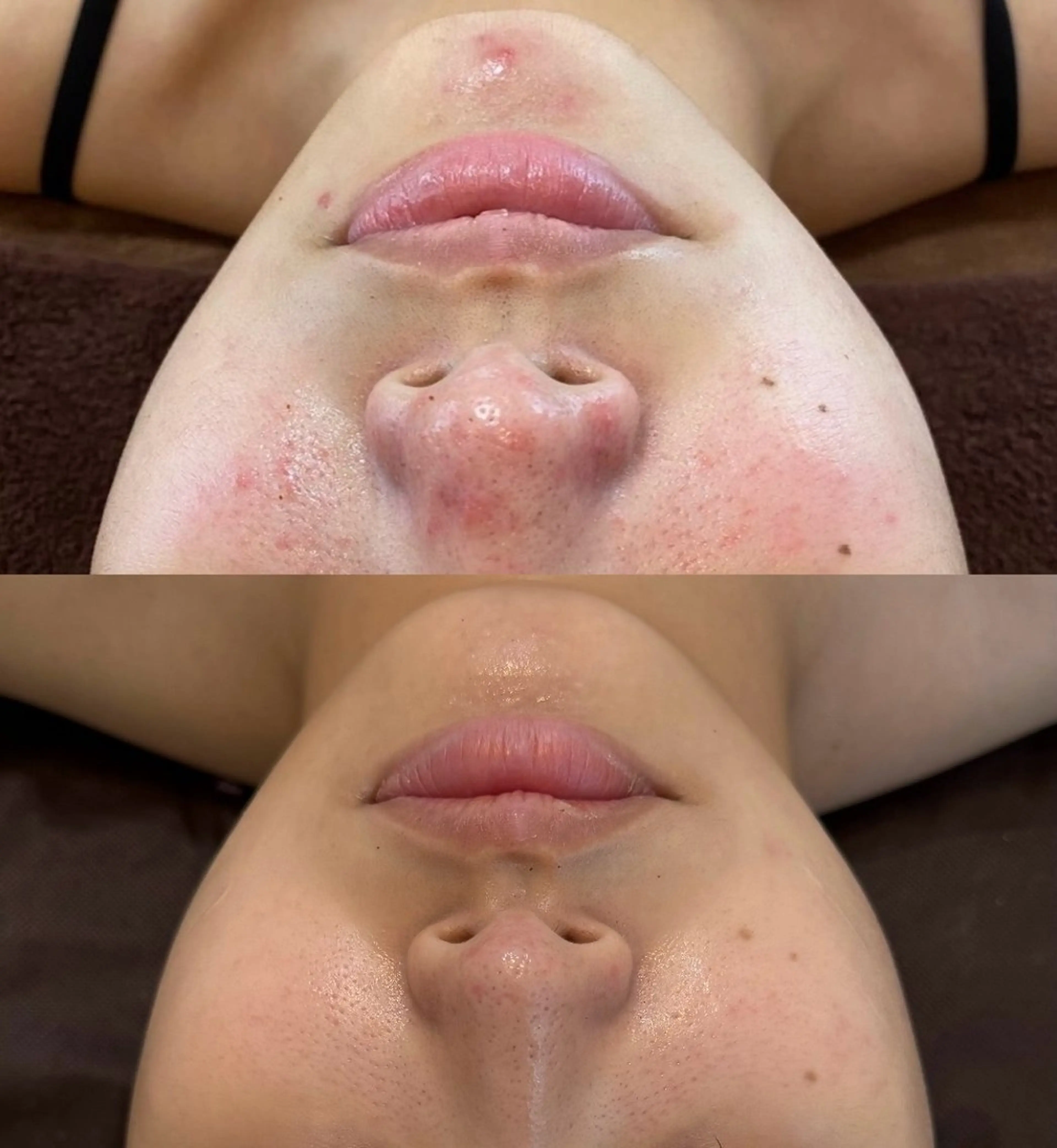 その他 Nicore所属・肌質改善🌿まつ毛 chapiのその他イメージ