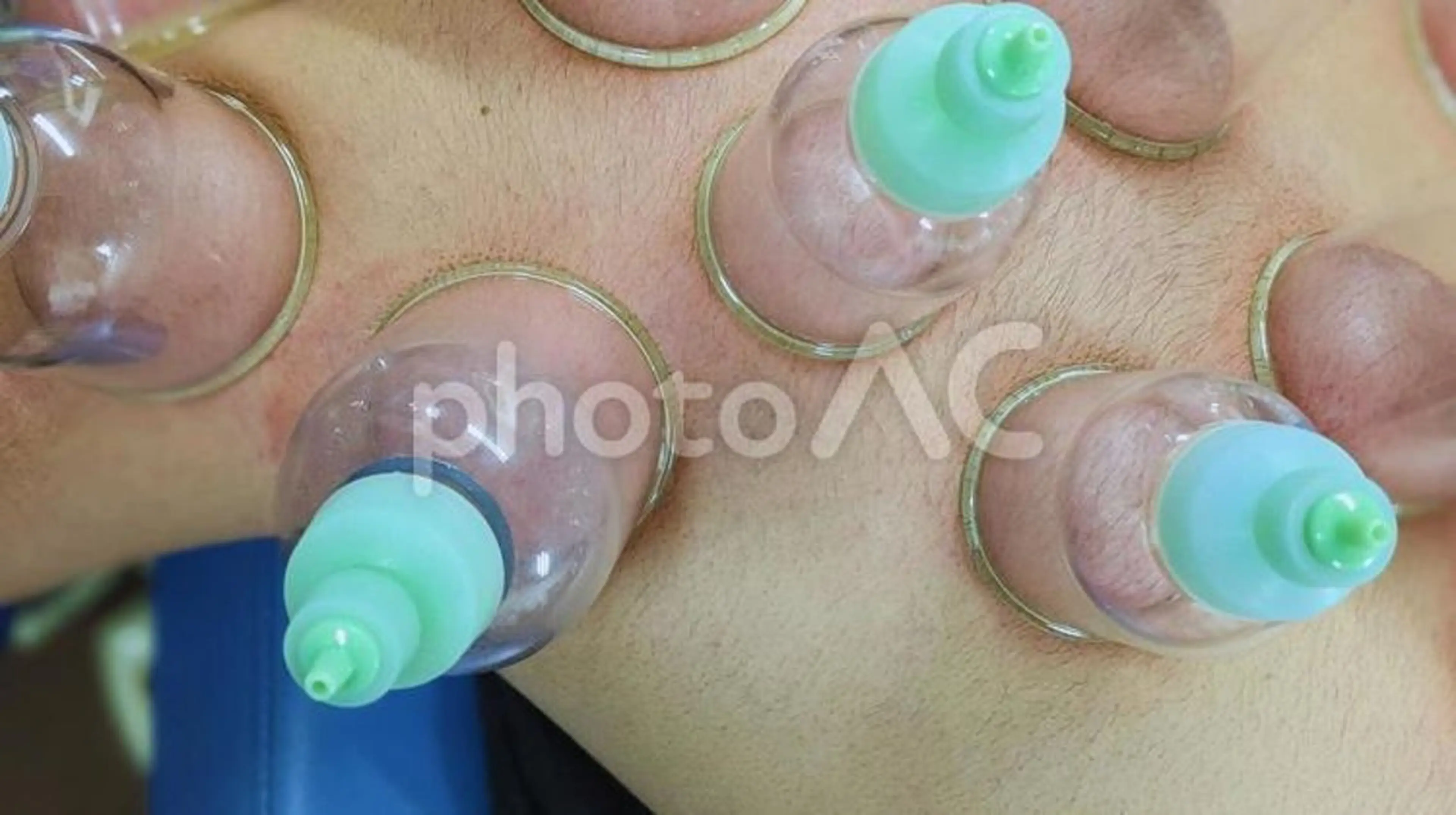 【温活40分】上半身✨全身温めヒートマット➕首コリ/肩コリ/肩甲骨コリにスライドカッピング➕アロマリンパマッサージ✨の写真