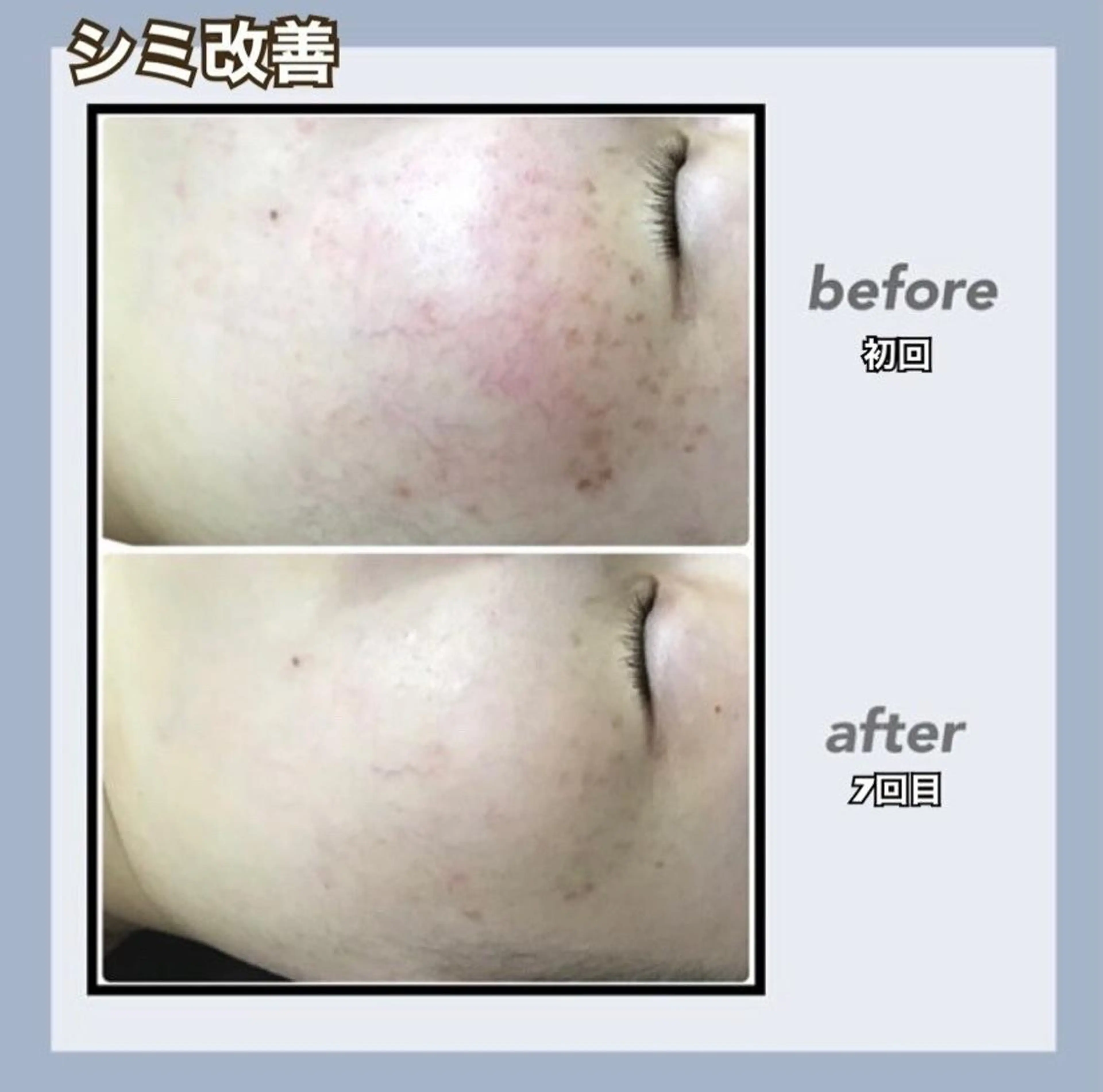 🌷U24毛穴エステ レイビスMURA🌷のエステ・リラクイメージ