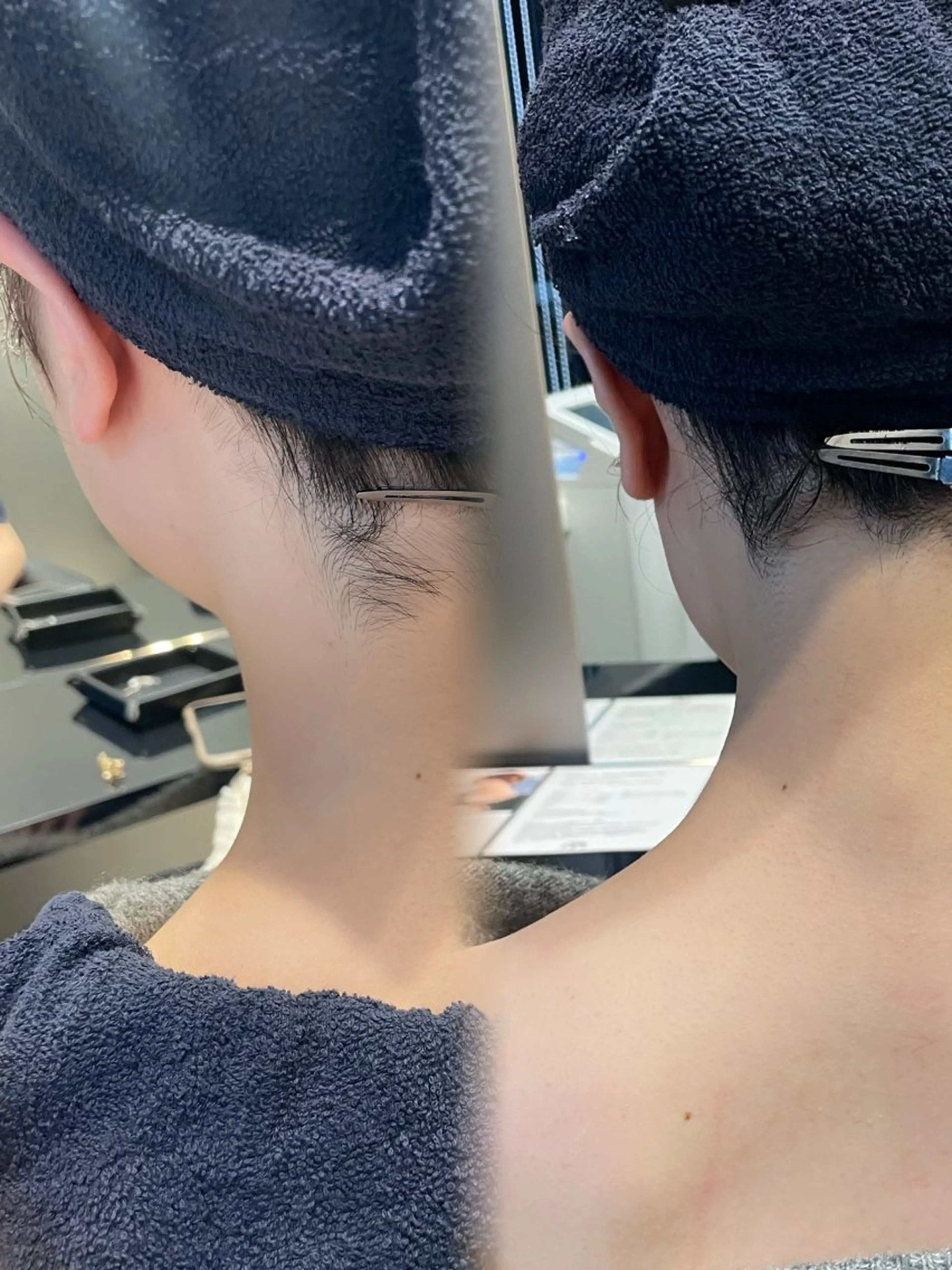 【うなじ脱毛】美容室だからできる✨うなじの形をデザインし脱毛します🌻頭皮クレンジングシャンプーブロー無料🤍🫧の写真