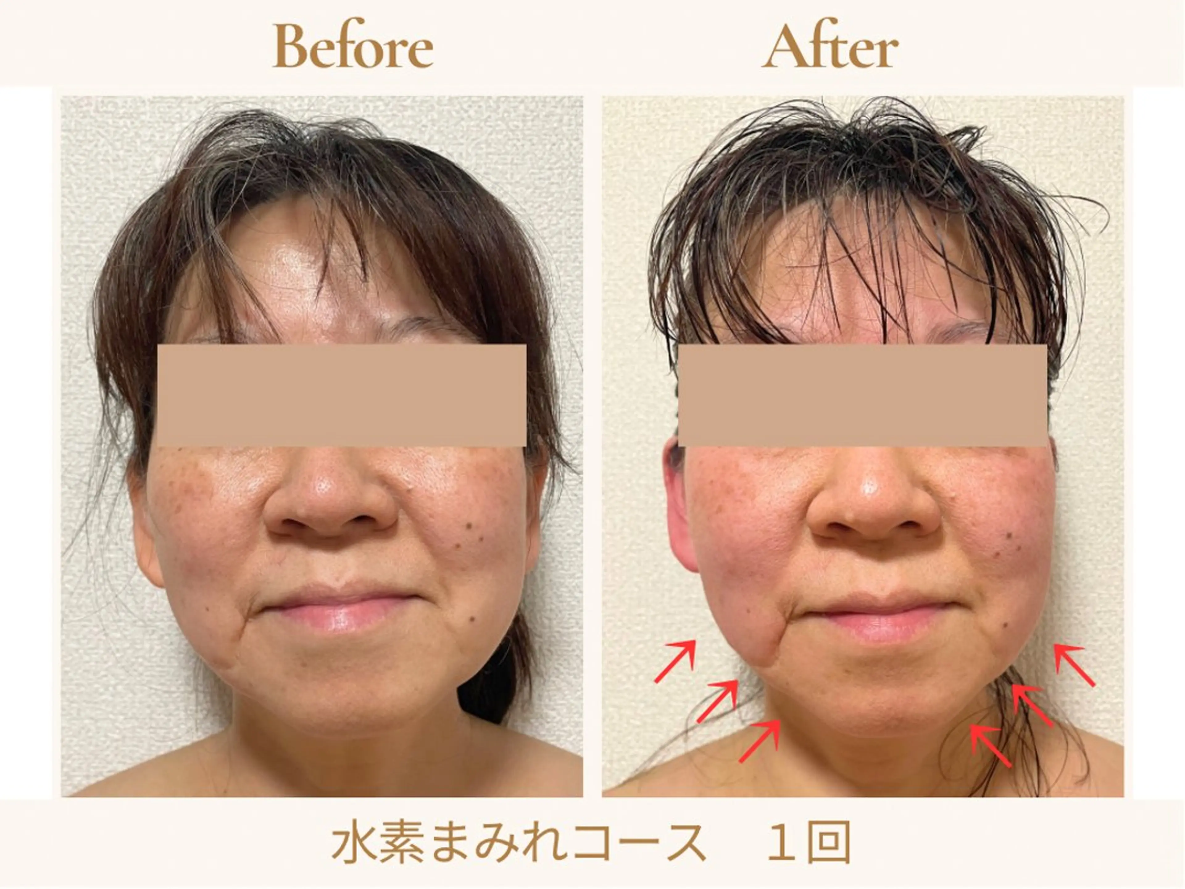 エステ リラク あみ|痩身の最先端 よもぎ蒸しサロン大塚のエステ・リラクイメージ