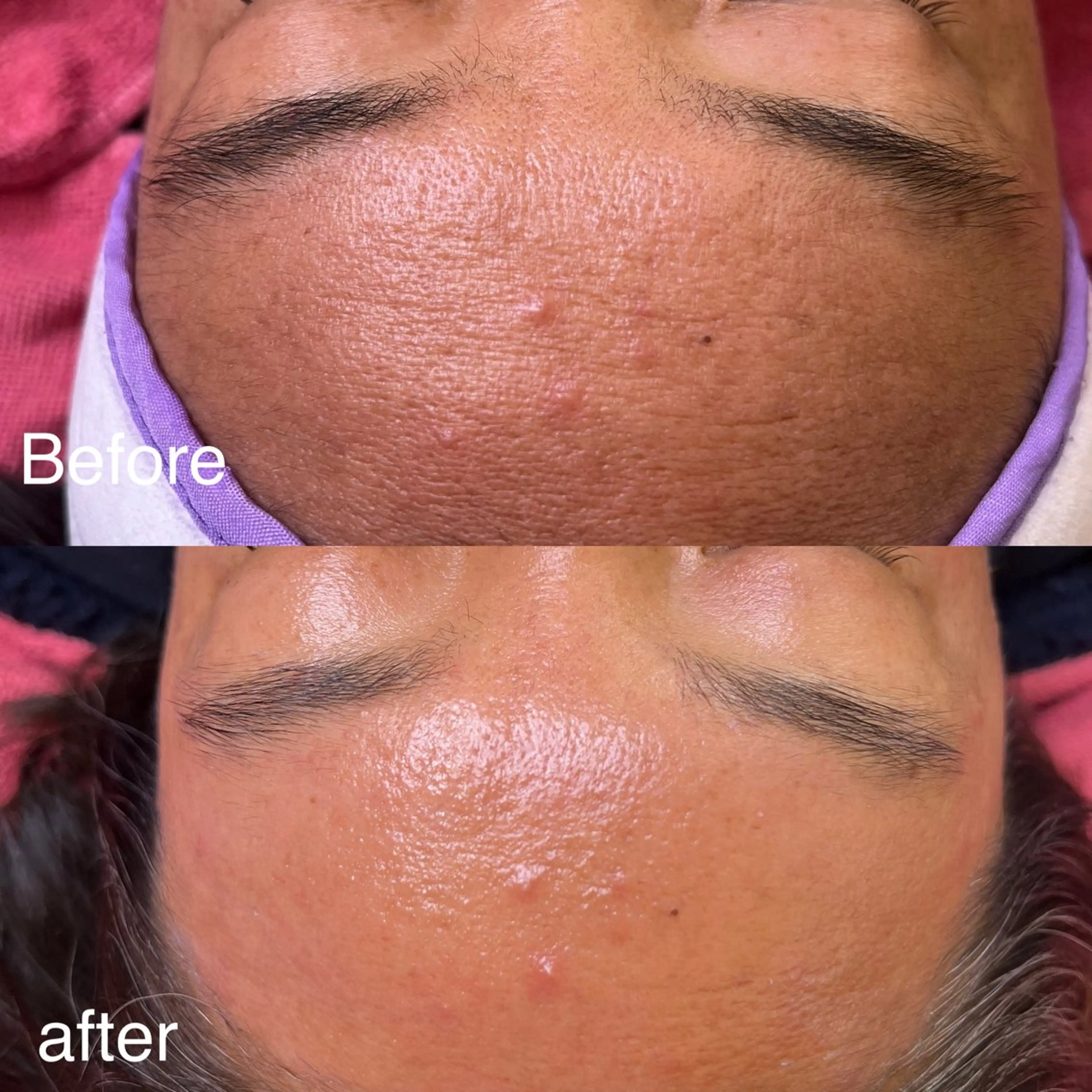 美崎 美乃のマツエク・マツパデザイン