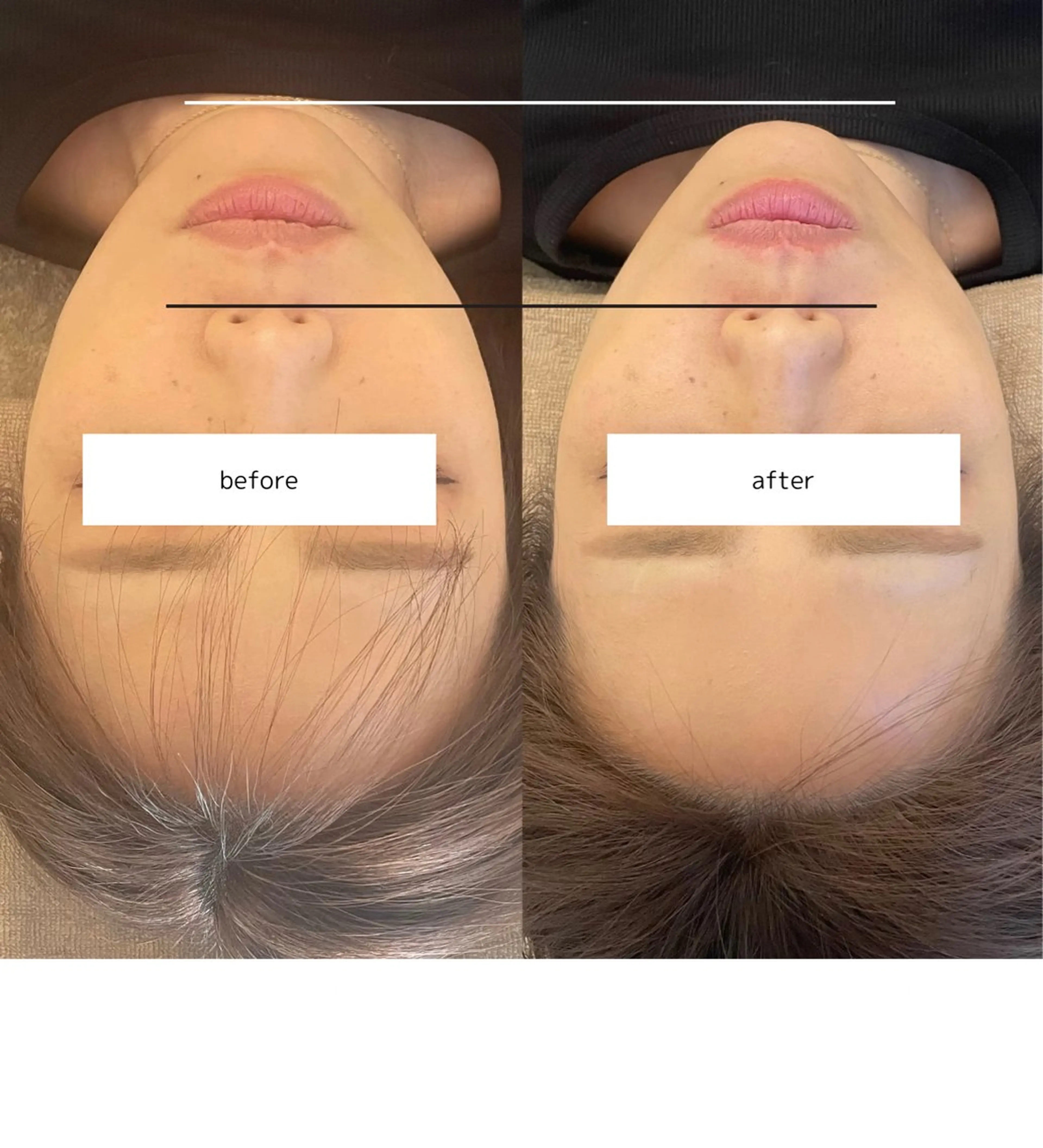 エステ 【小顔痩身専門看護師 サロンSONA】のエステ・リラクイメージ