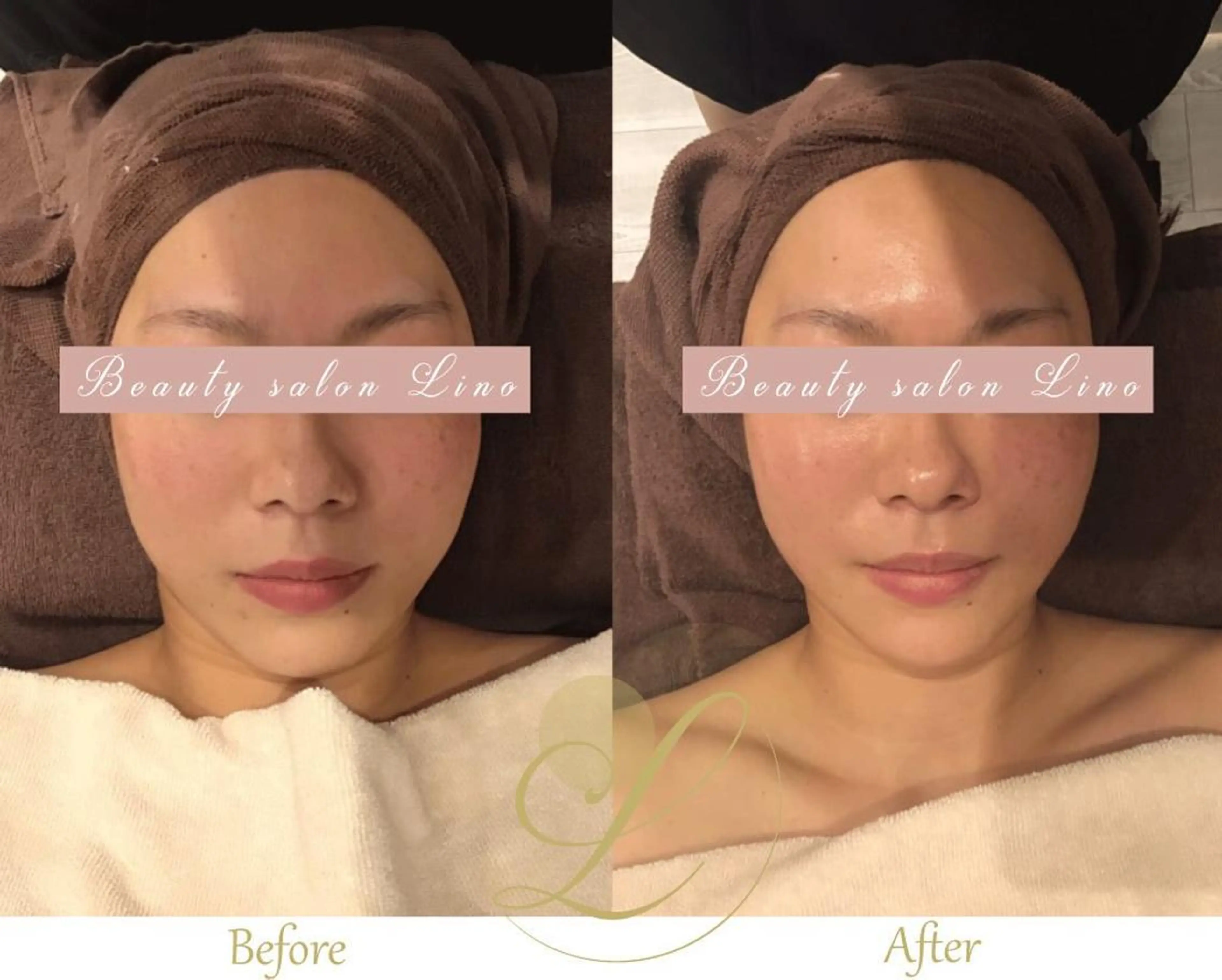 ブライダルサロン ｜Lino【堀江】のエステ・リラクイメージ