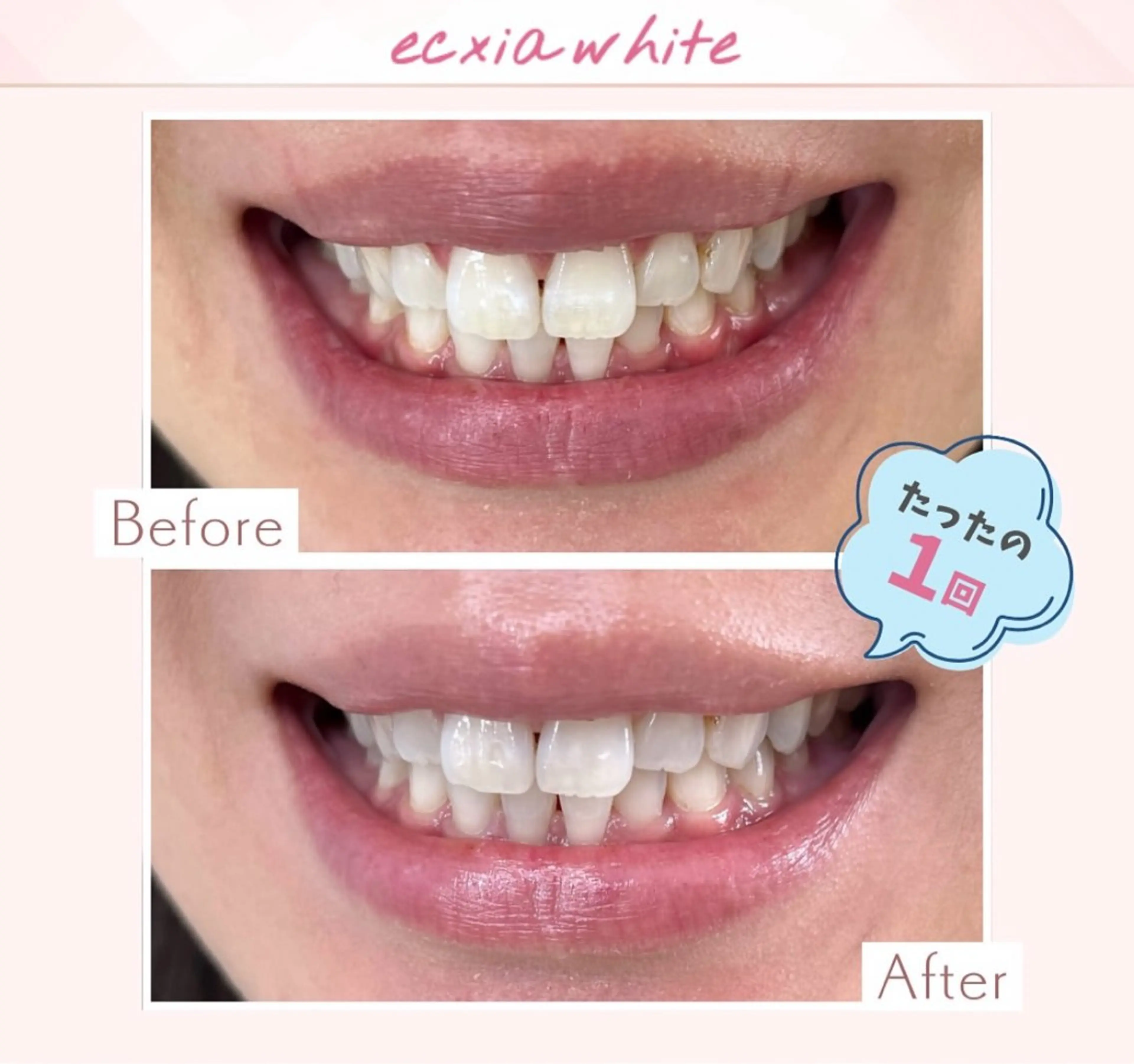 yumi❤︎ ホワイトニングのその他イメージ