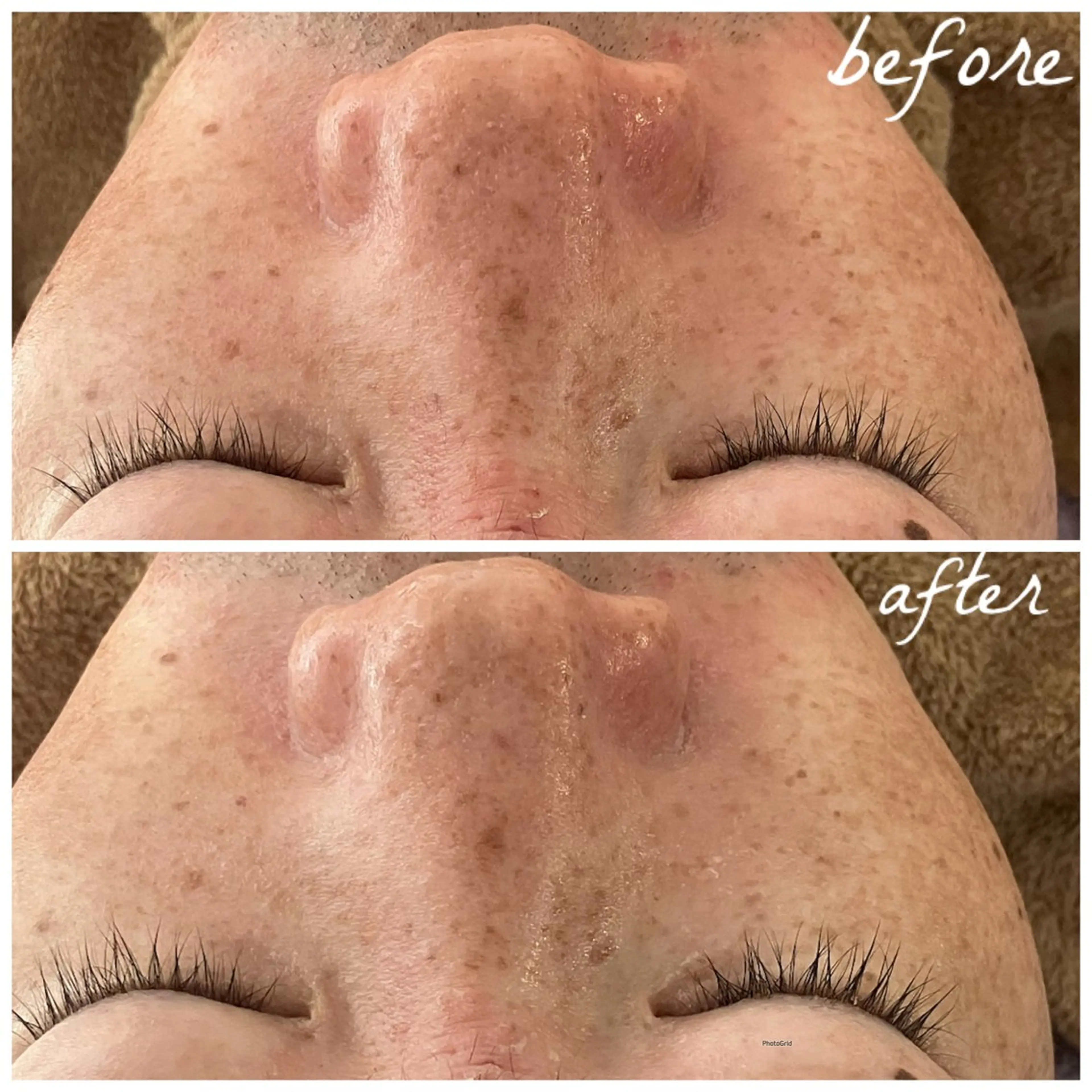 メンズ エステ メナード岐阜茜部 杉浦のエステ・リラクイメージ