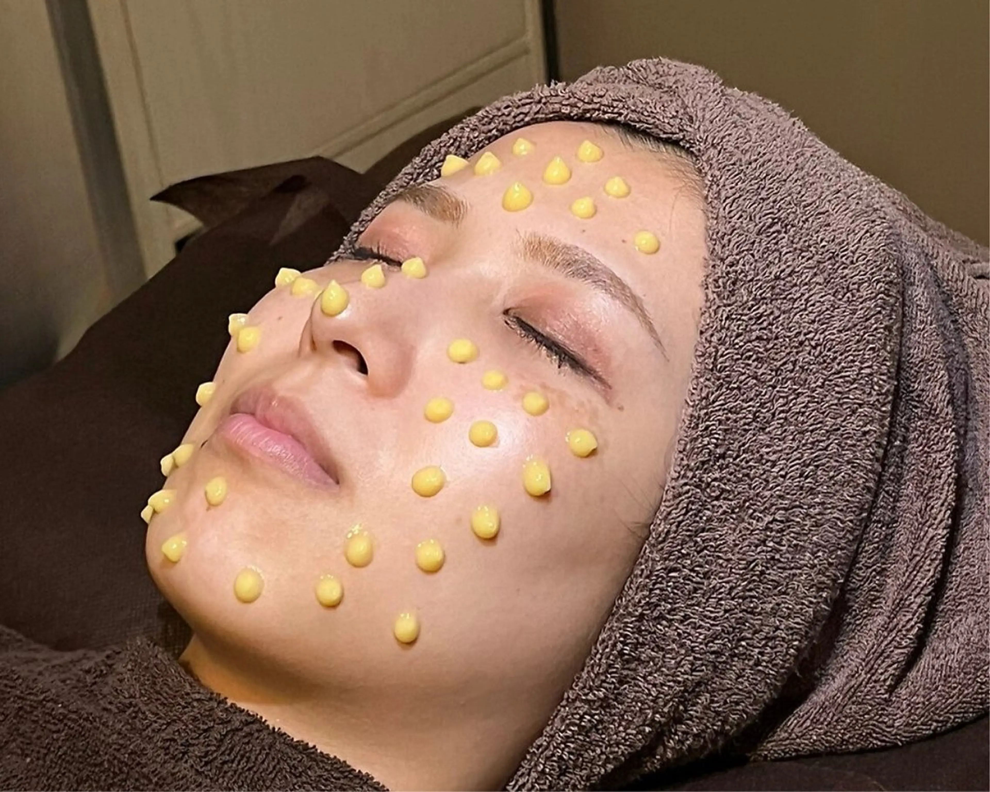 【人気No. 1】即効性◎毛穴、ニキビケア⚫︎マイクロニードル×レチノール［認定店］¥6000の写真