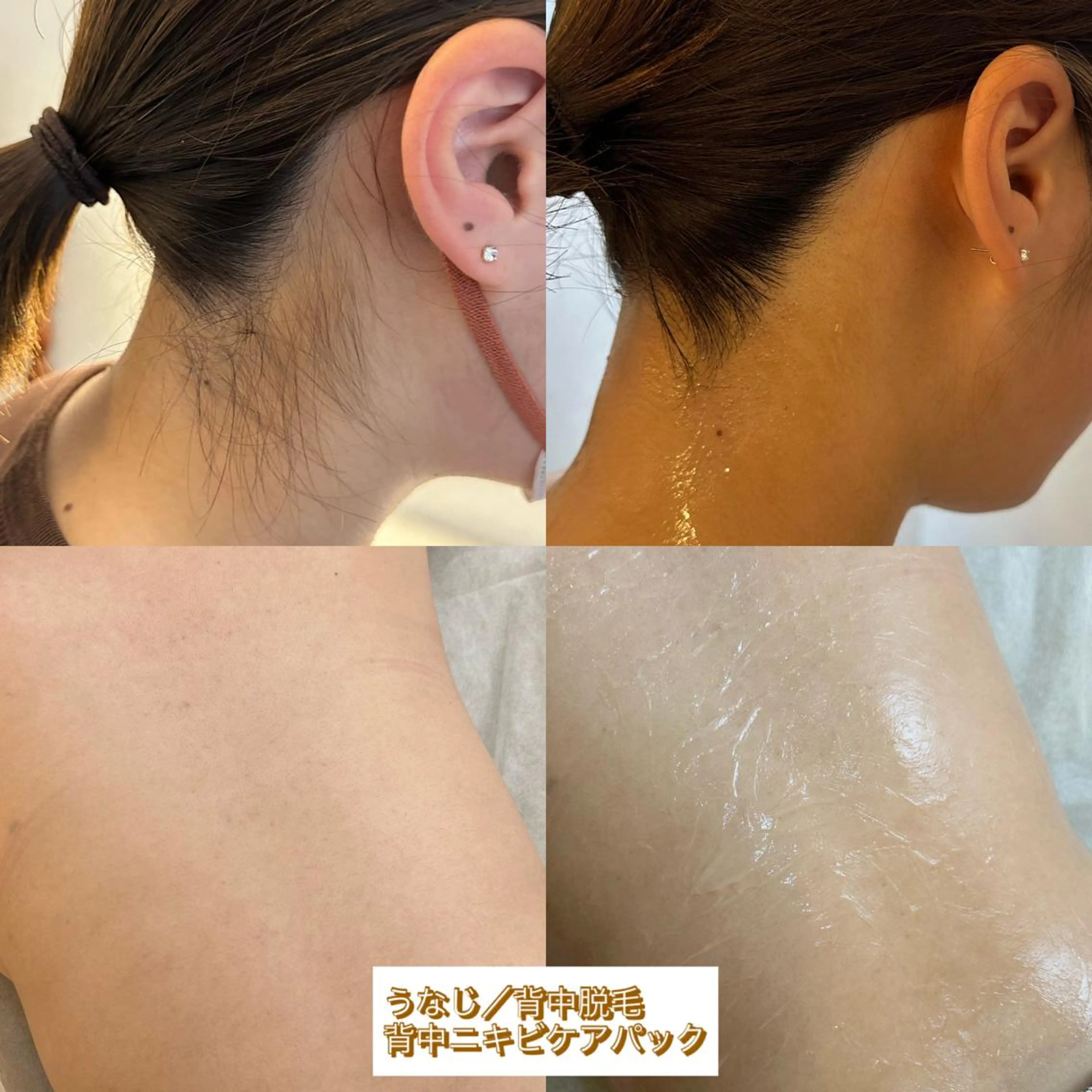 うなじ脱毛/美肌脱毛 LABELのエステ・リラクイメージ