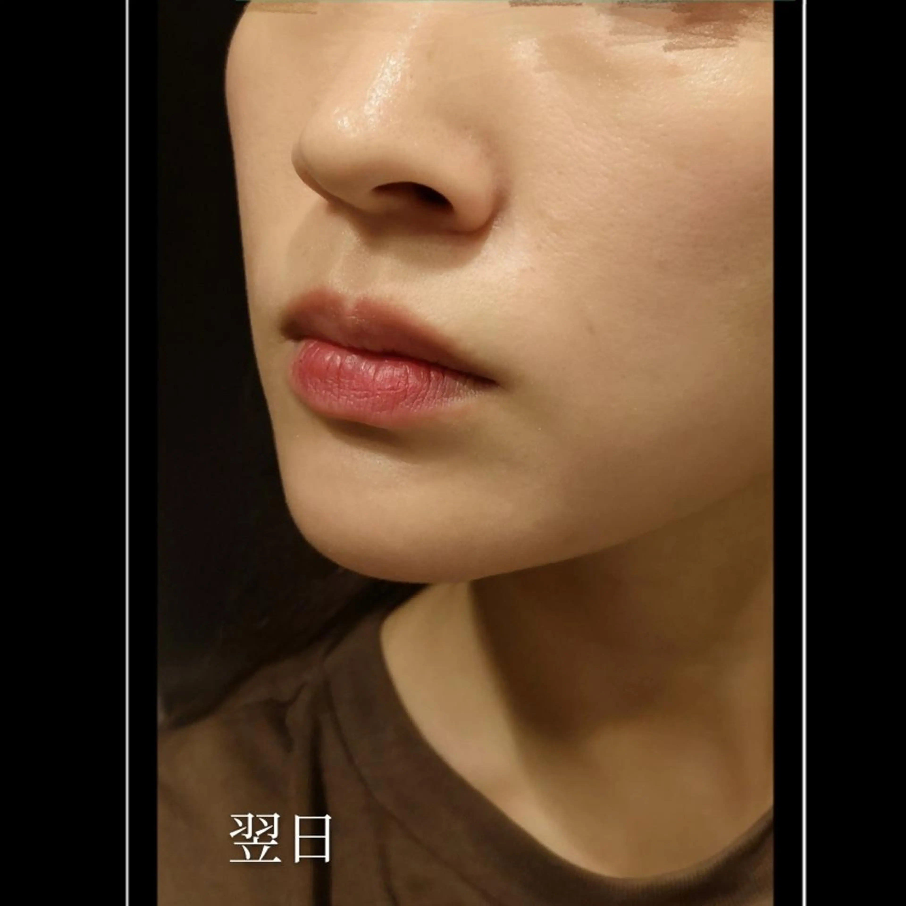 オススメ❢美容のプロたちがみとめる金賞受賞の最新幹細胞ハーブトリートメント　3㌘の写真