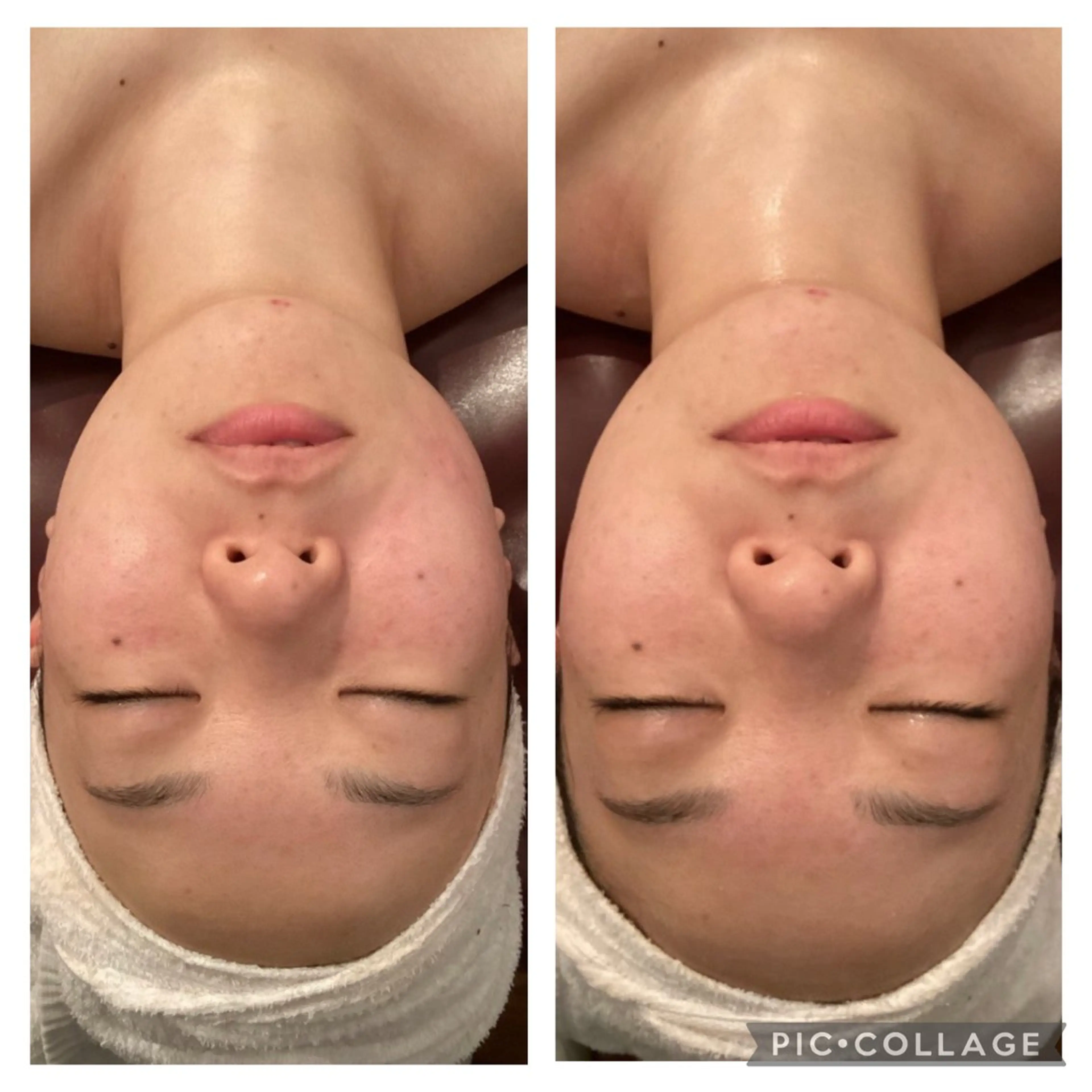 💕時短/即効性＆小顔コルギ💕40分 デコルテ、首リンパ、ヘッドスパ、美容マスク付きの写真