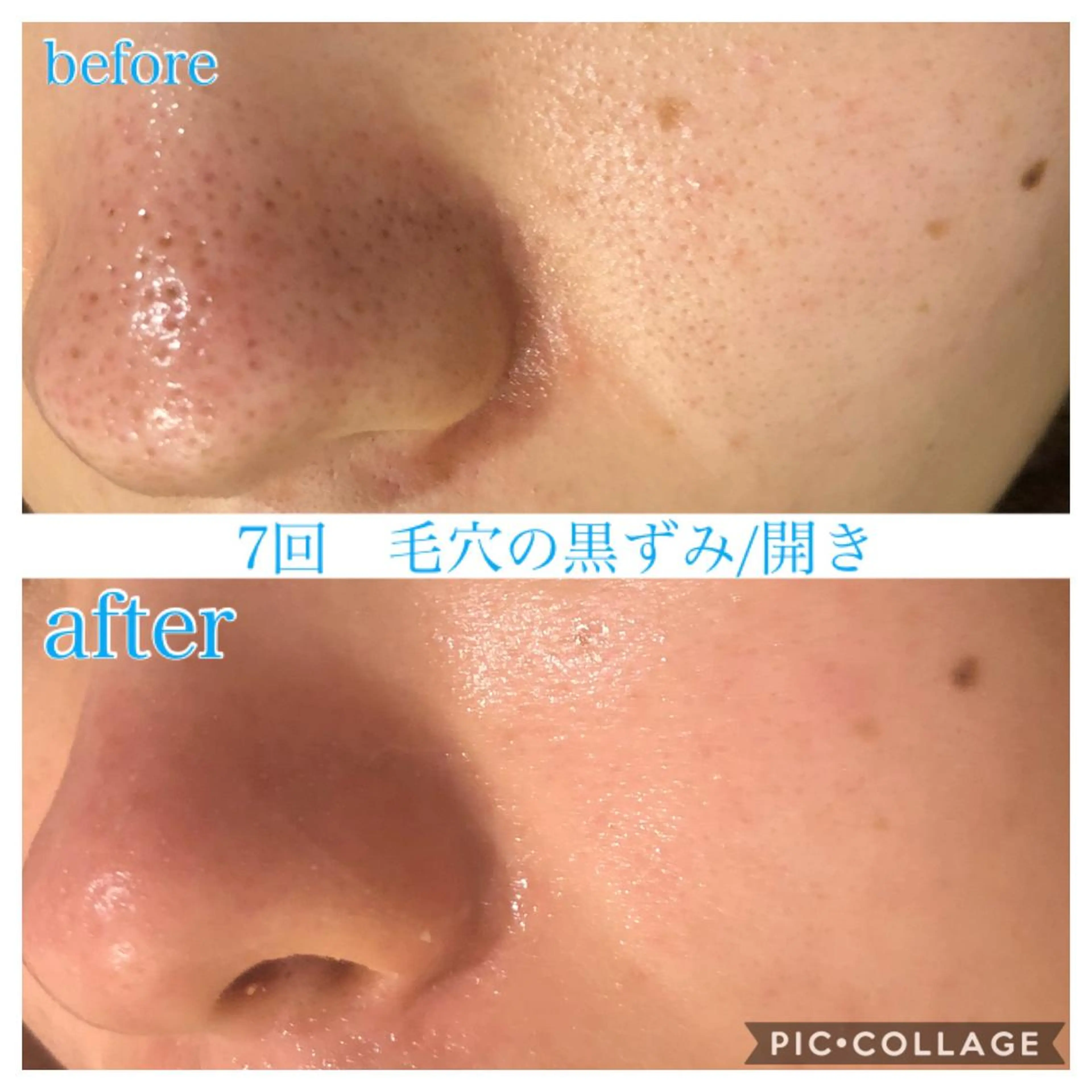 ロング カラー パーマ ヘアアレンジ メンズ ネイル マツエク・マツパ エステ リラク Ensor Clair所属・EnsorClair 代表　野口真央のエステ・リラクイメージ