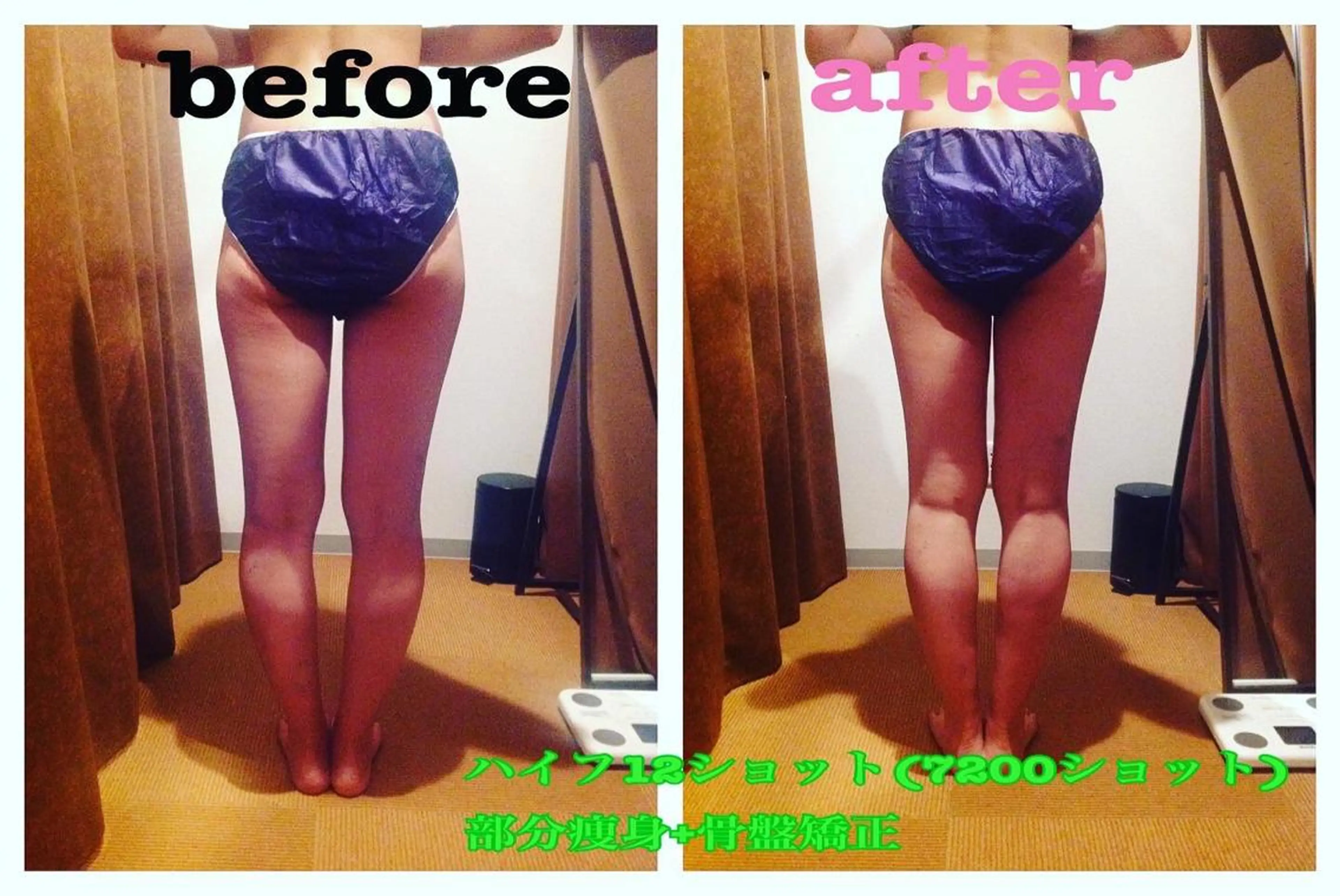 シミケア&オーダーメイド痩身専門店Bloom所属・坂田 真紀のエステ・リラクイメージ