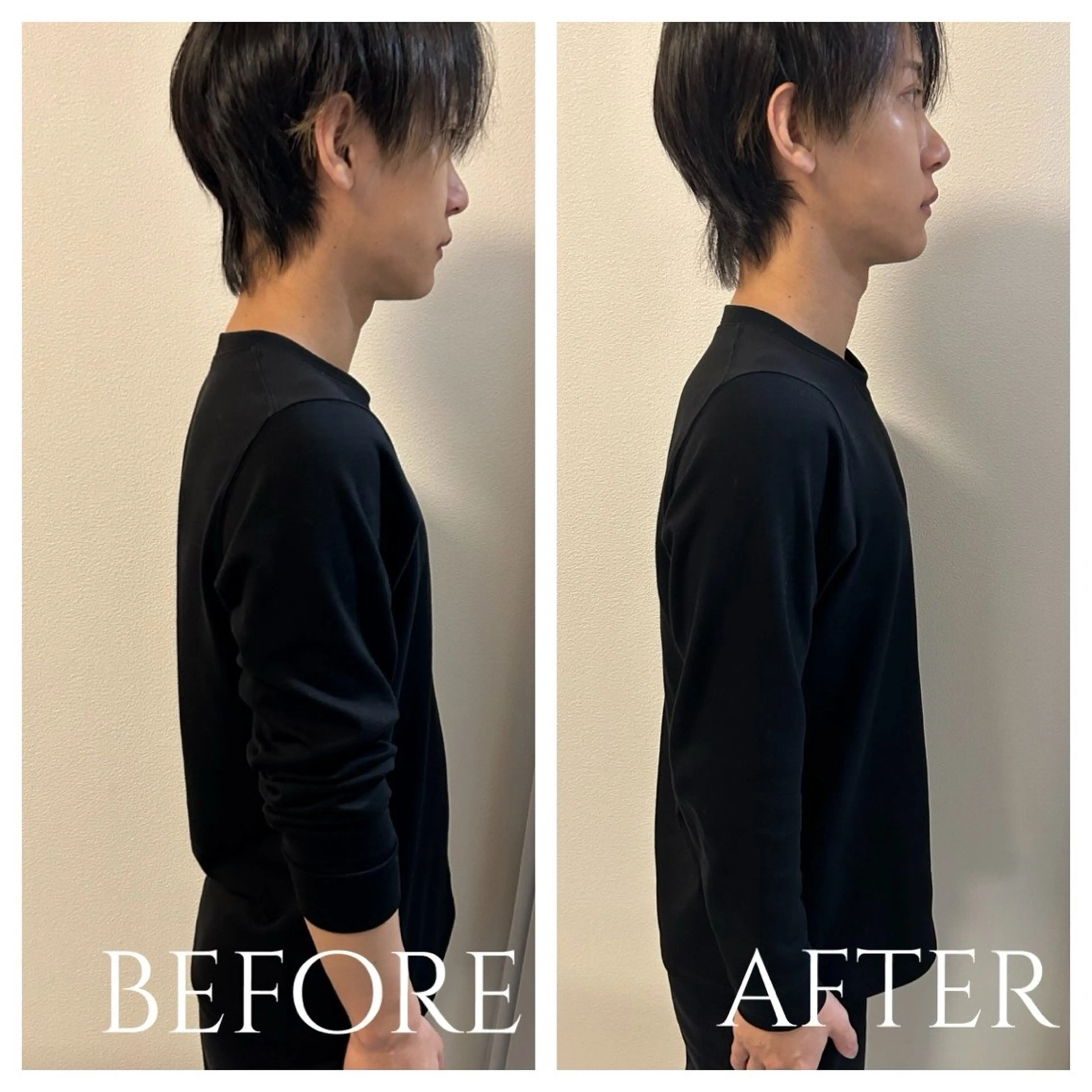 【ねじれを直して根本改善🌀】姿勢矯正の写真