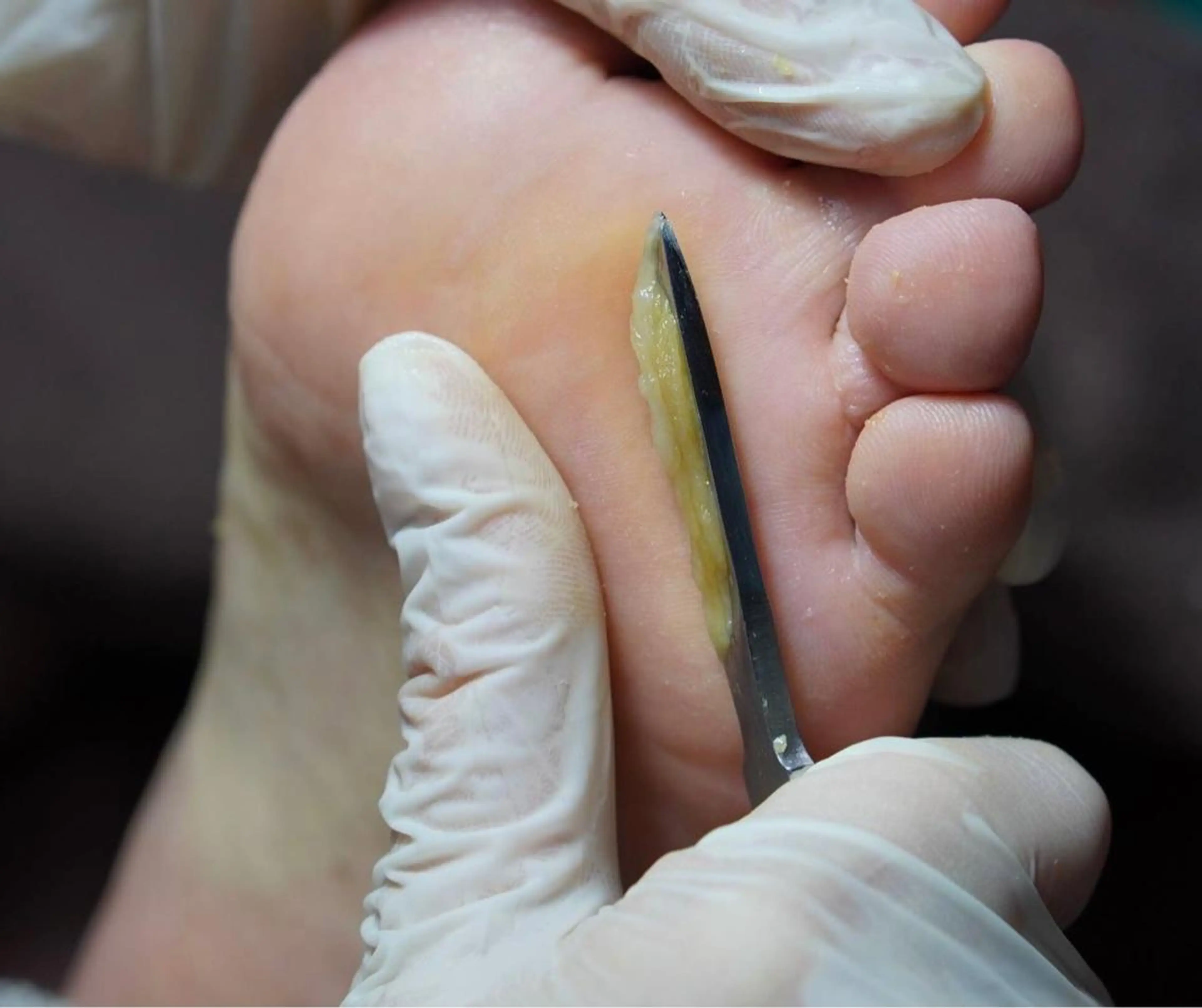 ネイル Takasaki Keikoのネイルデザイン