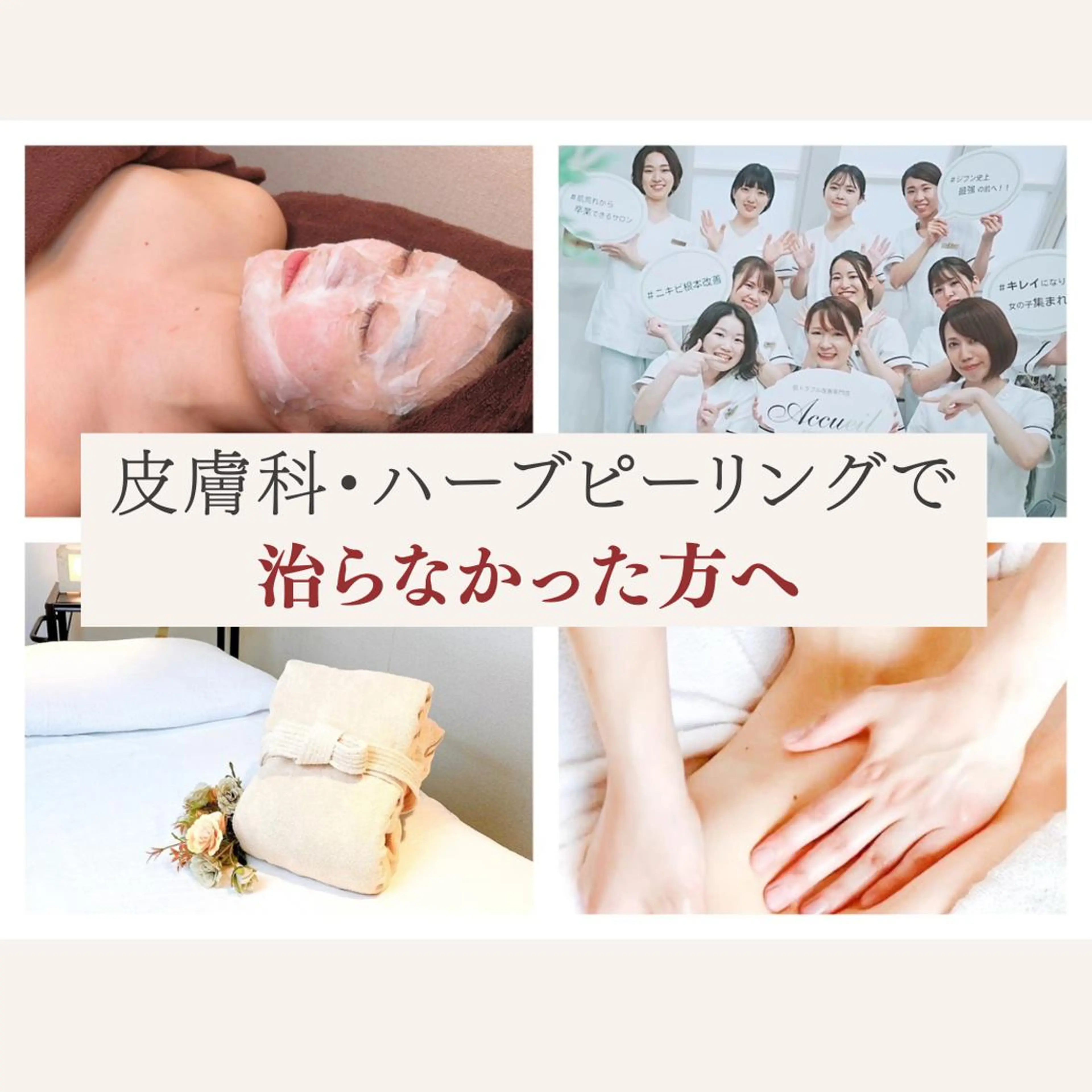 重度ニキビ専門🌷 ダウンタイムなしのエステ・リラクイメージ