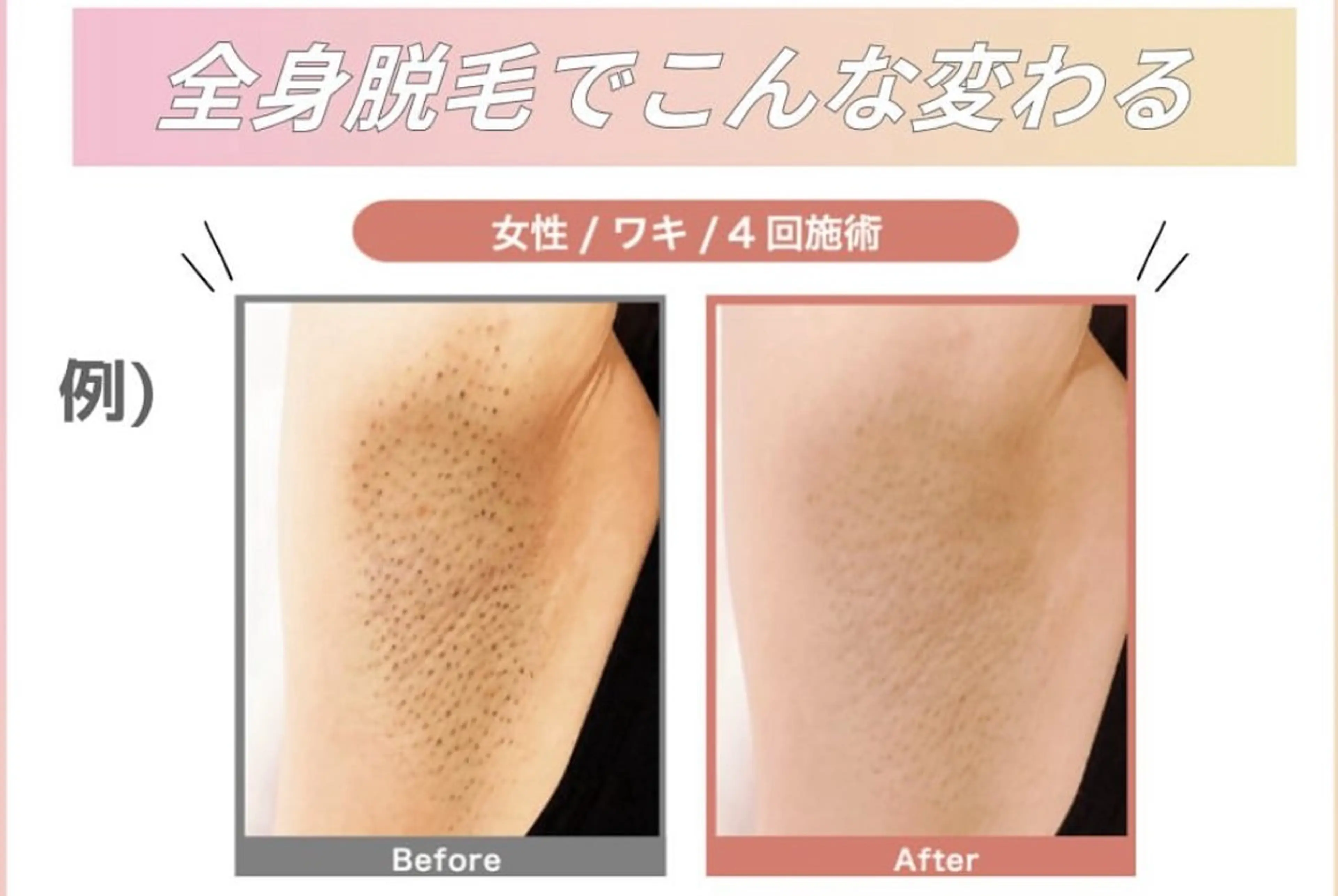 脱毛 美肌脱毛サロン muroのエステ・リラクイメージ