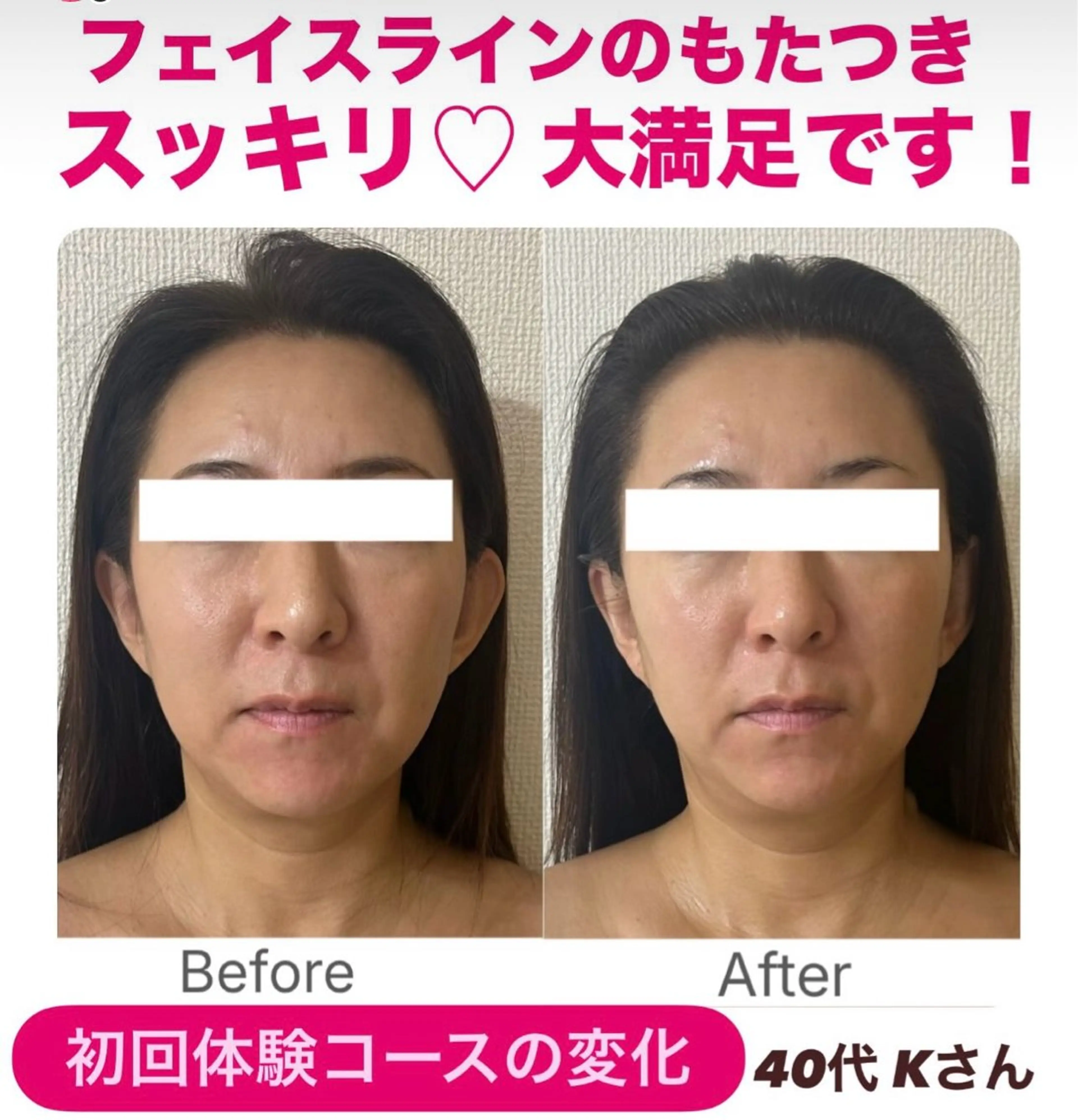 la lumie're (ラ リュミエール)所属・小顔サロン (ラ リュミエール)のエステ・リラクイメージ