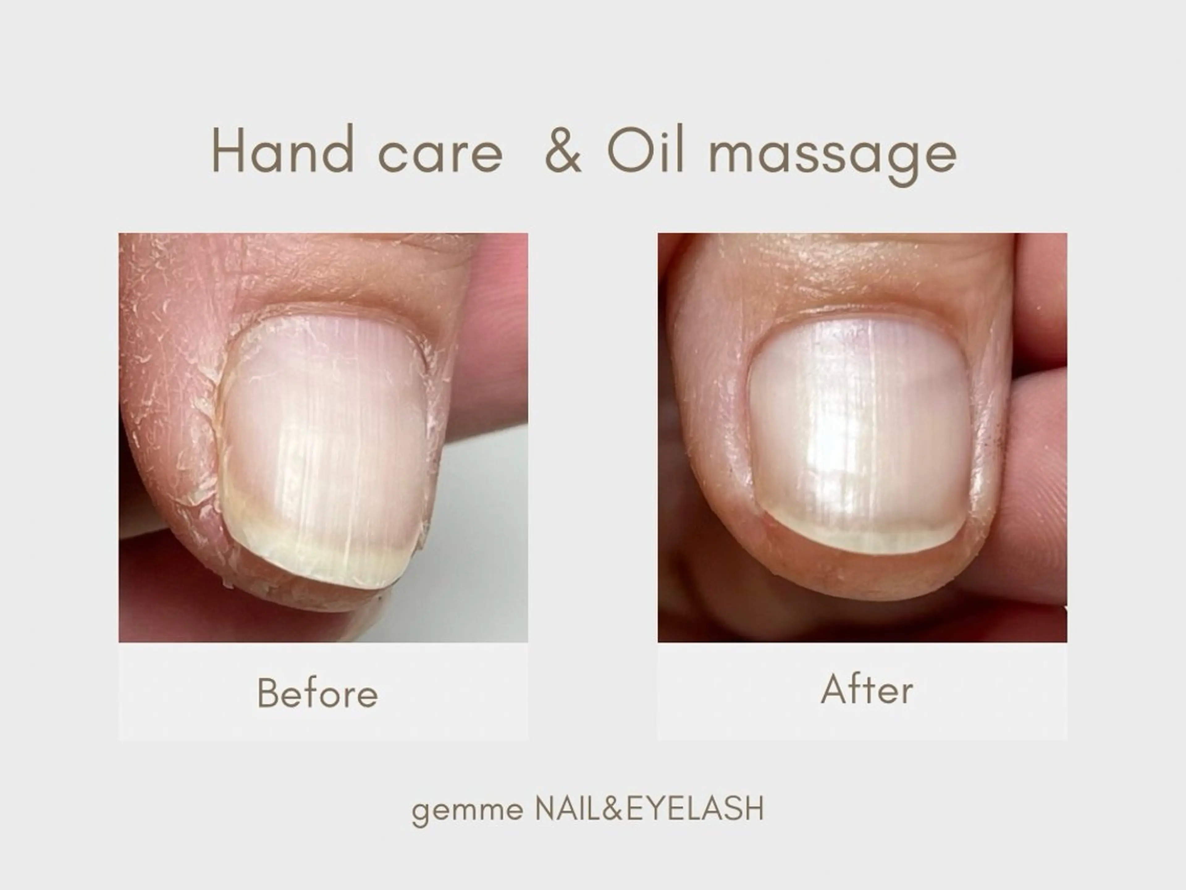 ケア特化サロンの美容液でネイルケア˖ ࣪⊹オイルトリートメント付き♩の写真