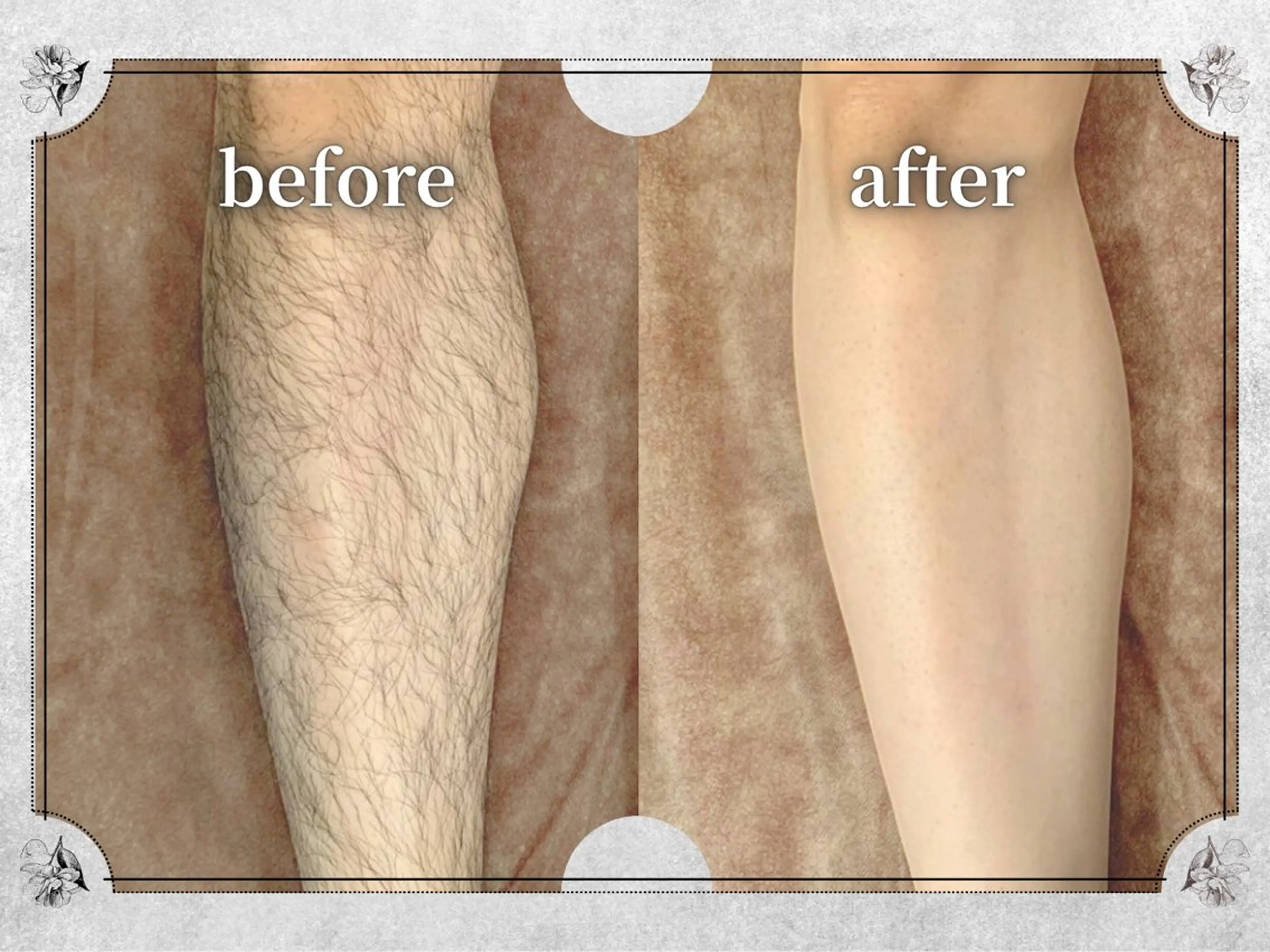 都度払い脱毛 Lino柏/Moneのエステ・リラクイメージ