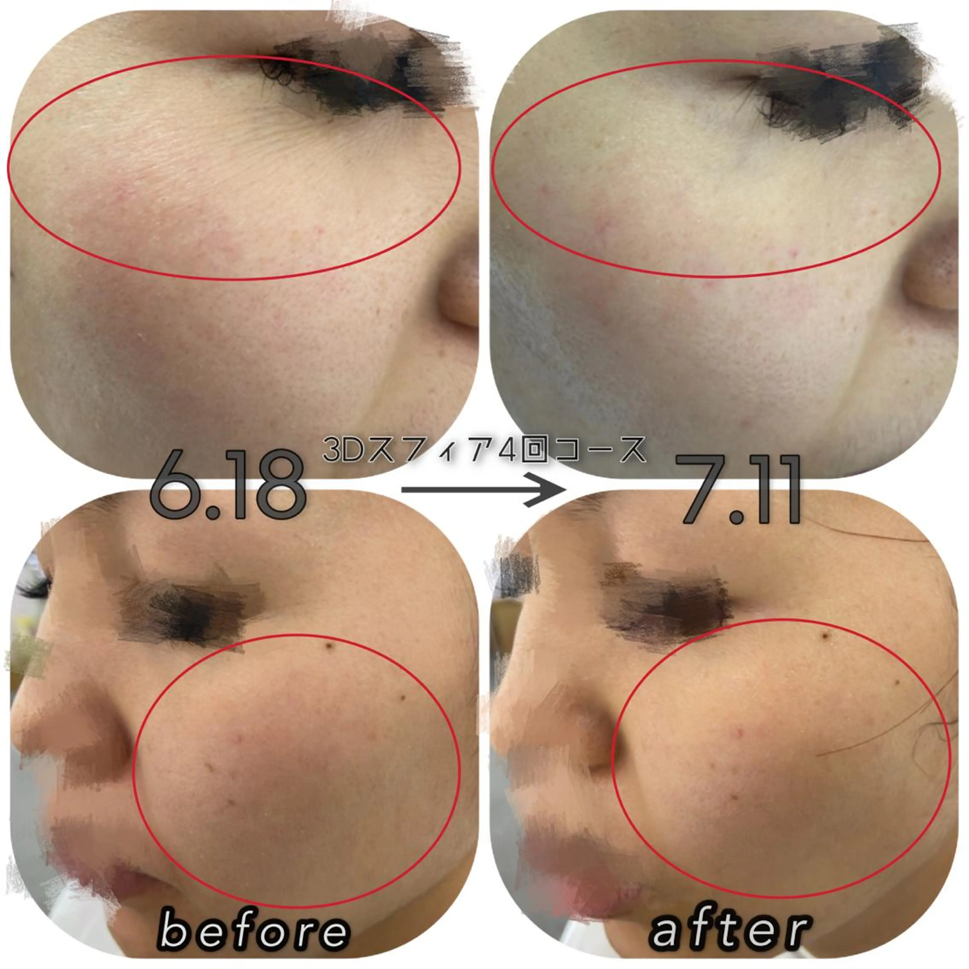 DeI'm 丸亀店所属・いおもり あやかのエステ・リラクイメージ