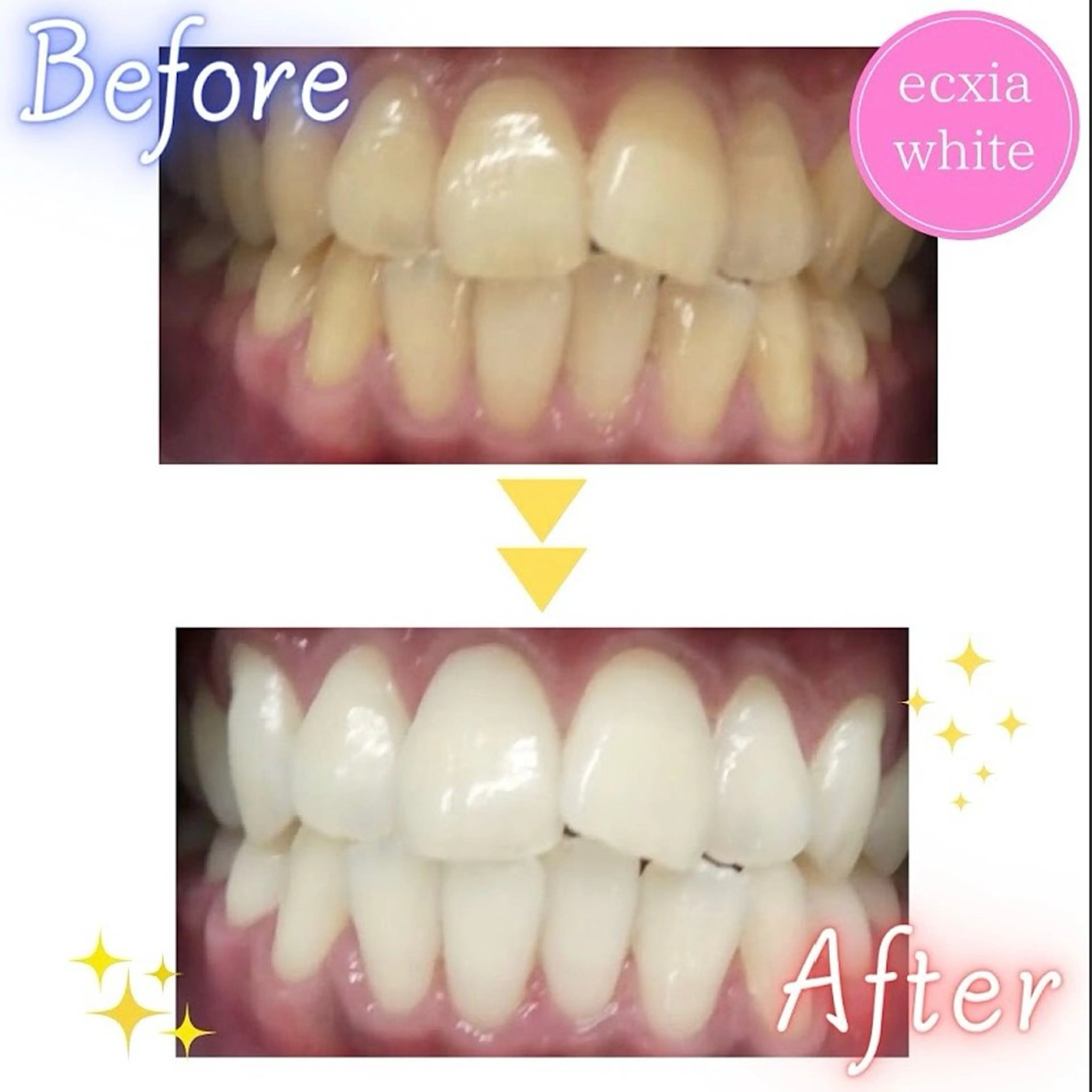 セルフホワイトニング エクシア前橋店のその他イメージ