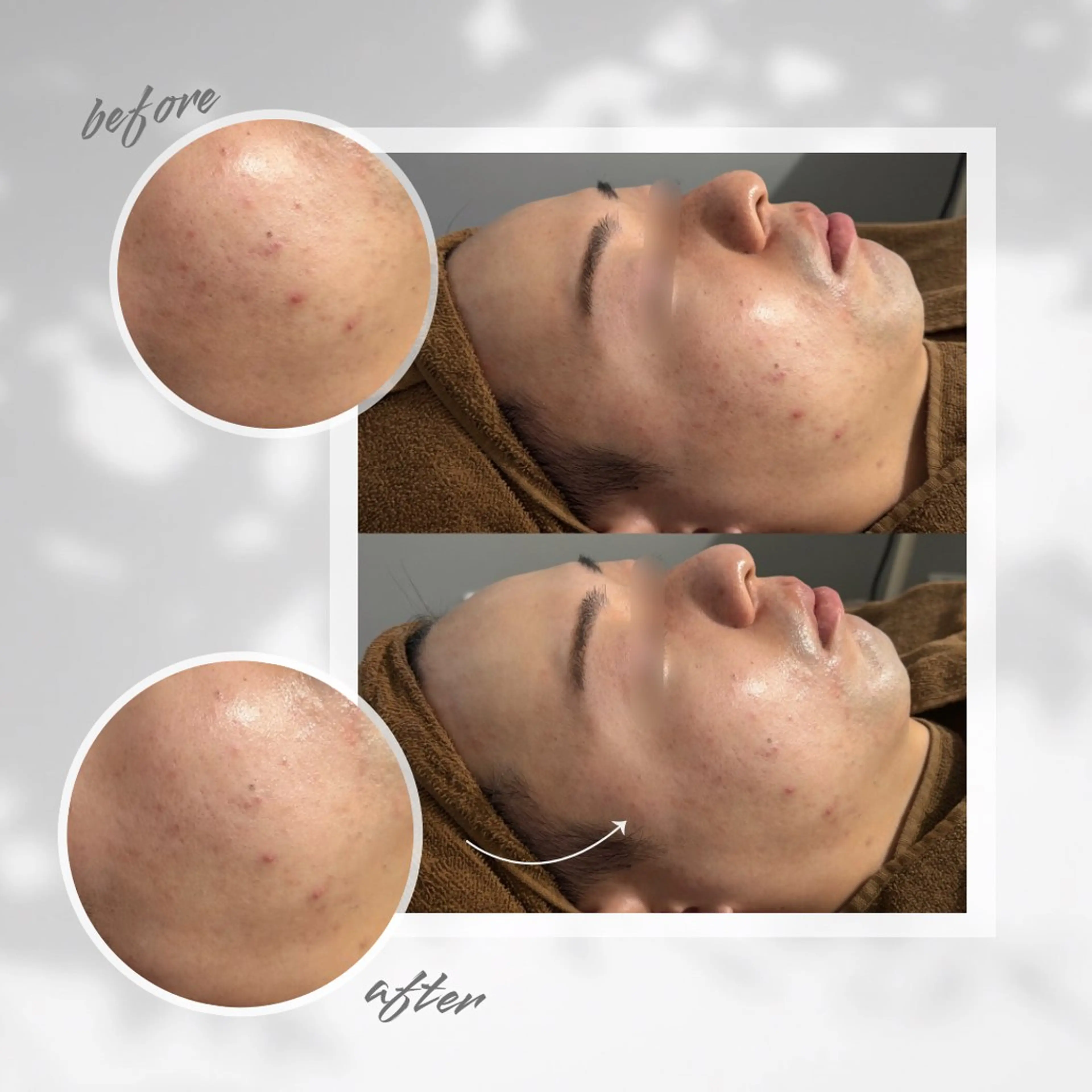 その他 ENCHANT Kaede/肌質改善のその他イメージ