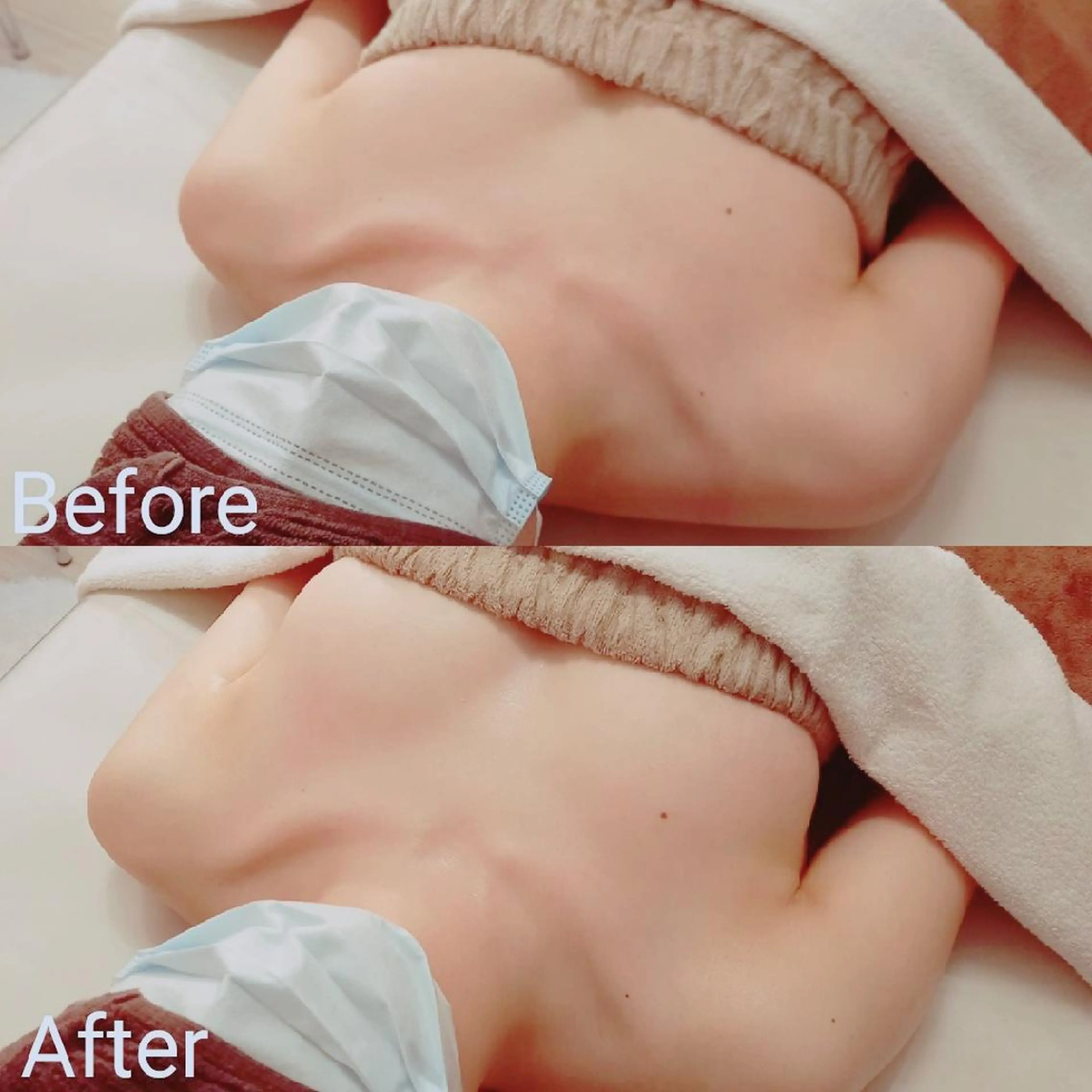 ミラクルバスト®プレミアムの写真