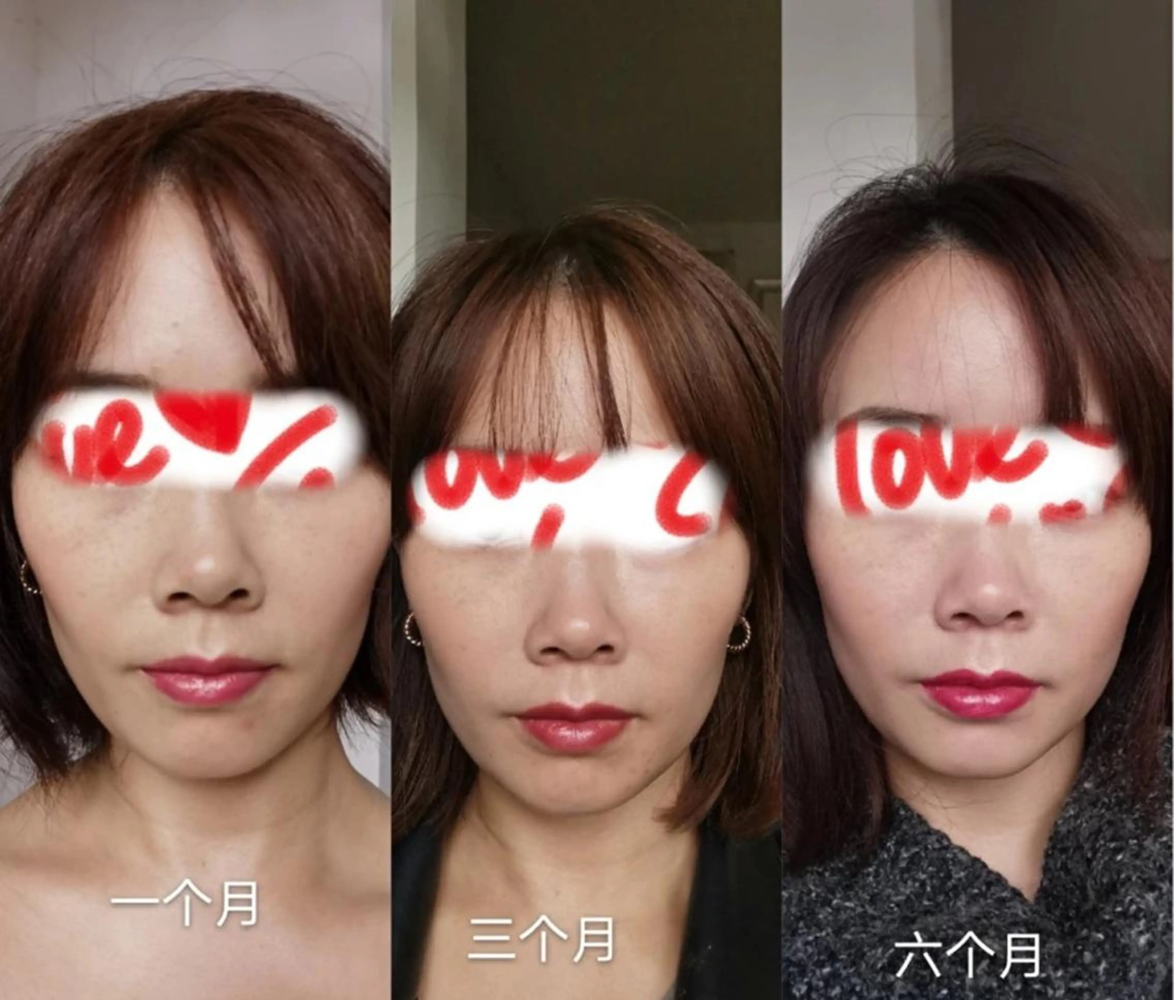 エステ aliaハーブ水光店 エステティシャン募集のエステ・リラクイメージ