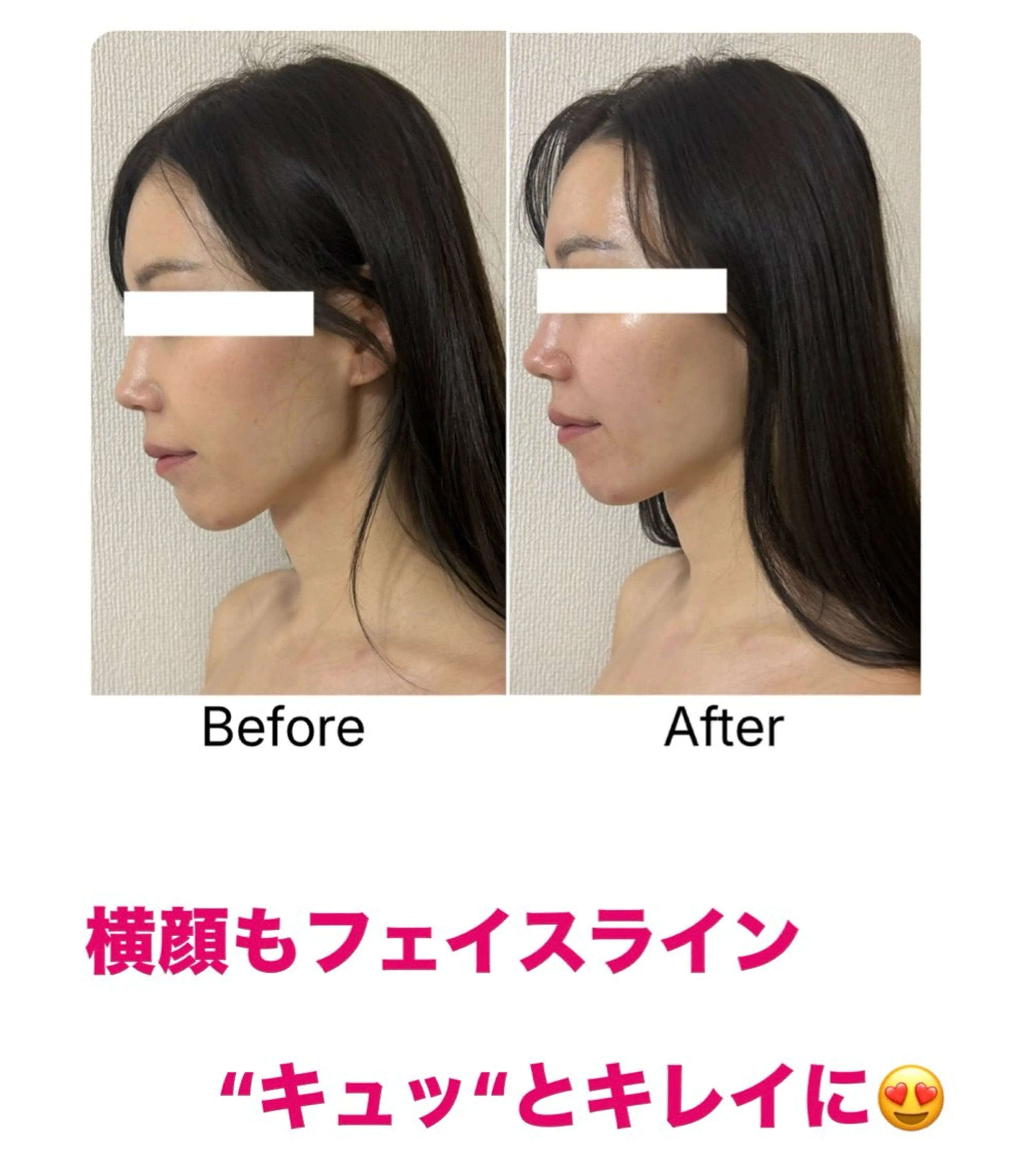 小顔サロン (ラ リュミエール)のエステ・リラクイメージ