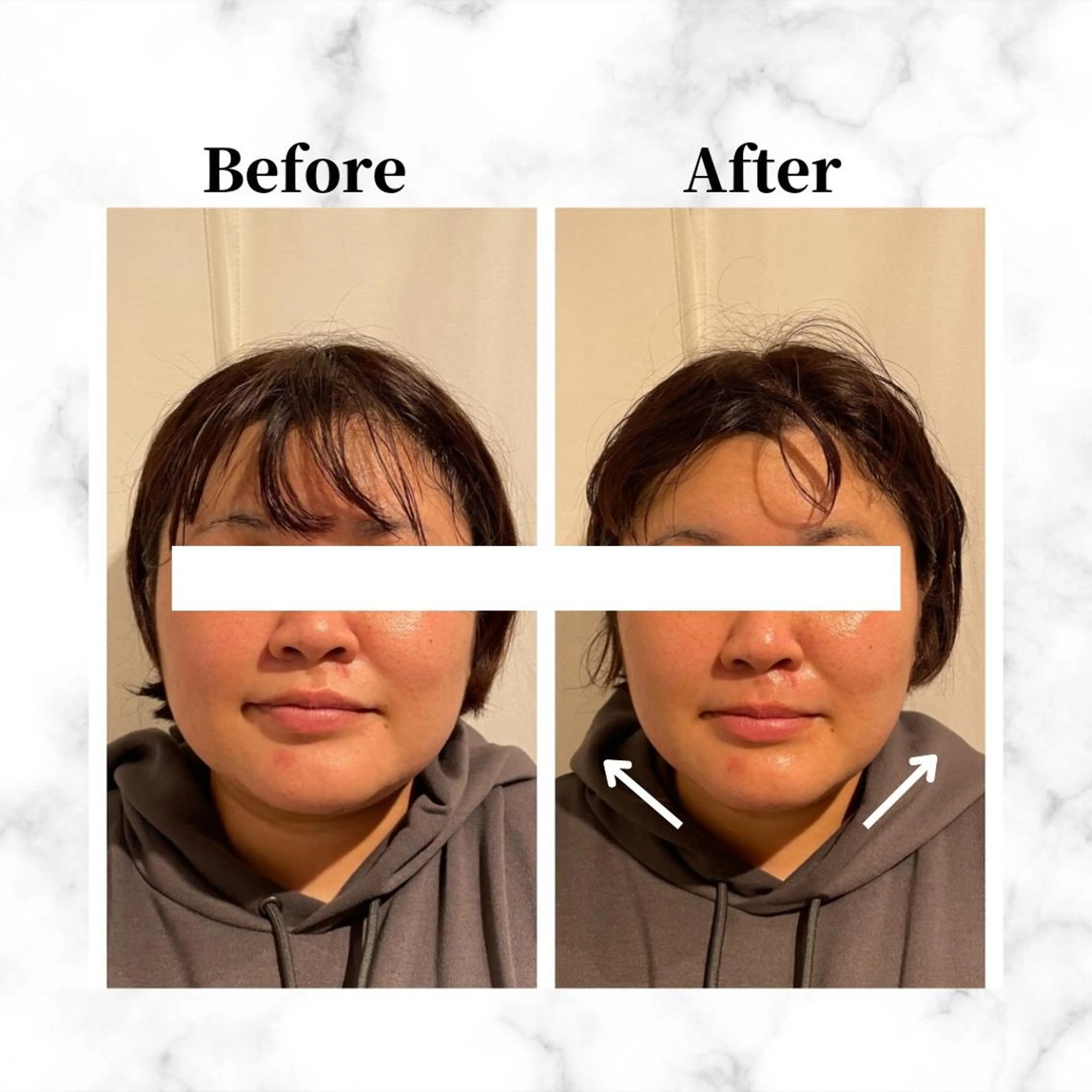 12Dハイフ💗 最強小顔のエステ・リラクイメージ