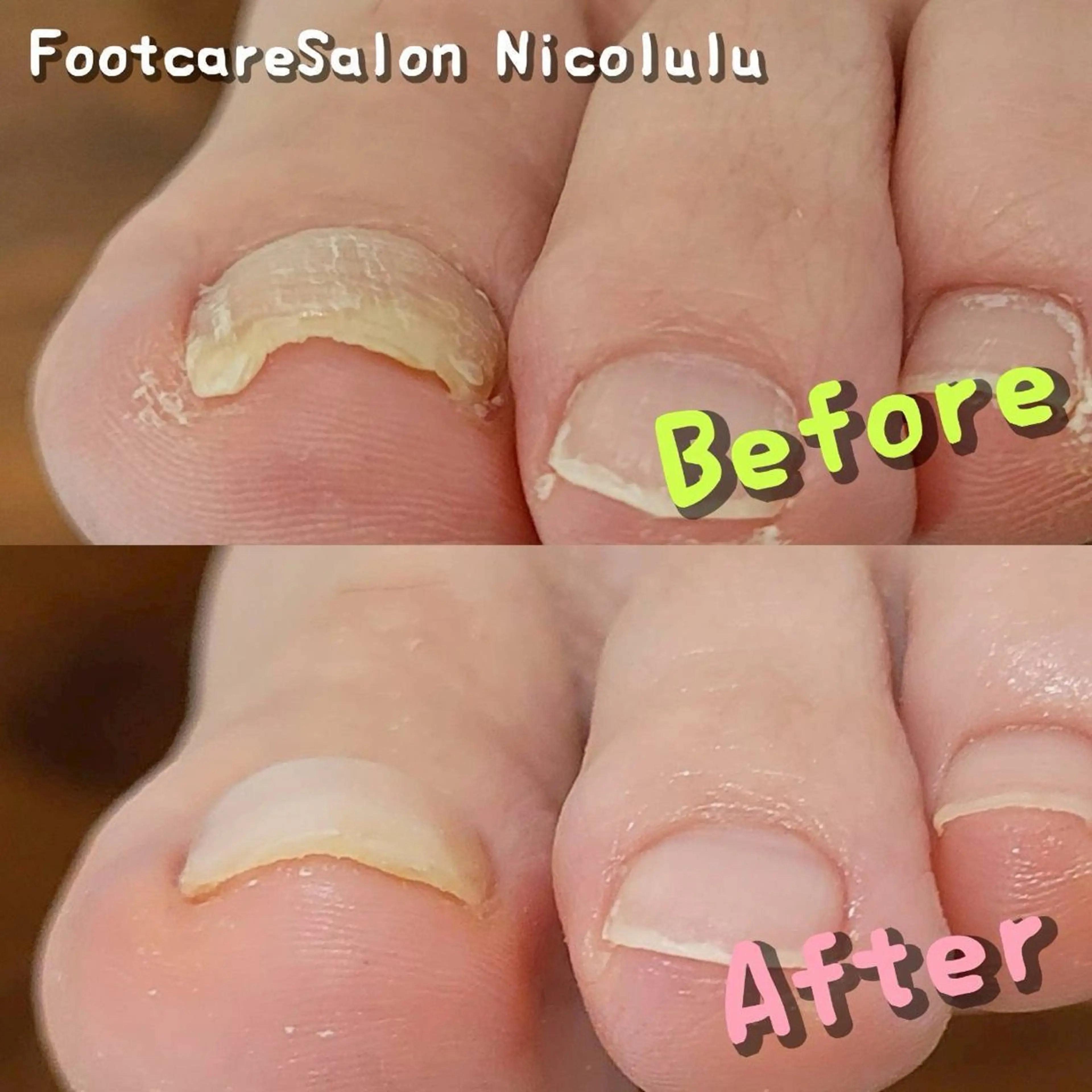 リラク 足トラブル専門 ニコルル金沢のエステ・リラクイメージ