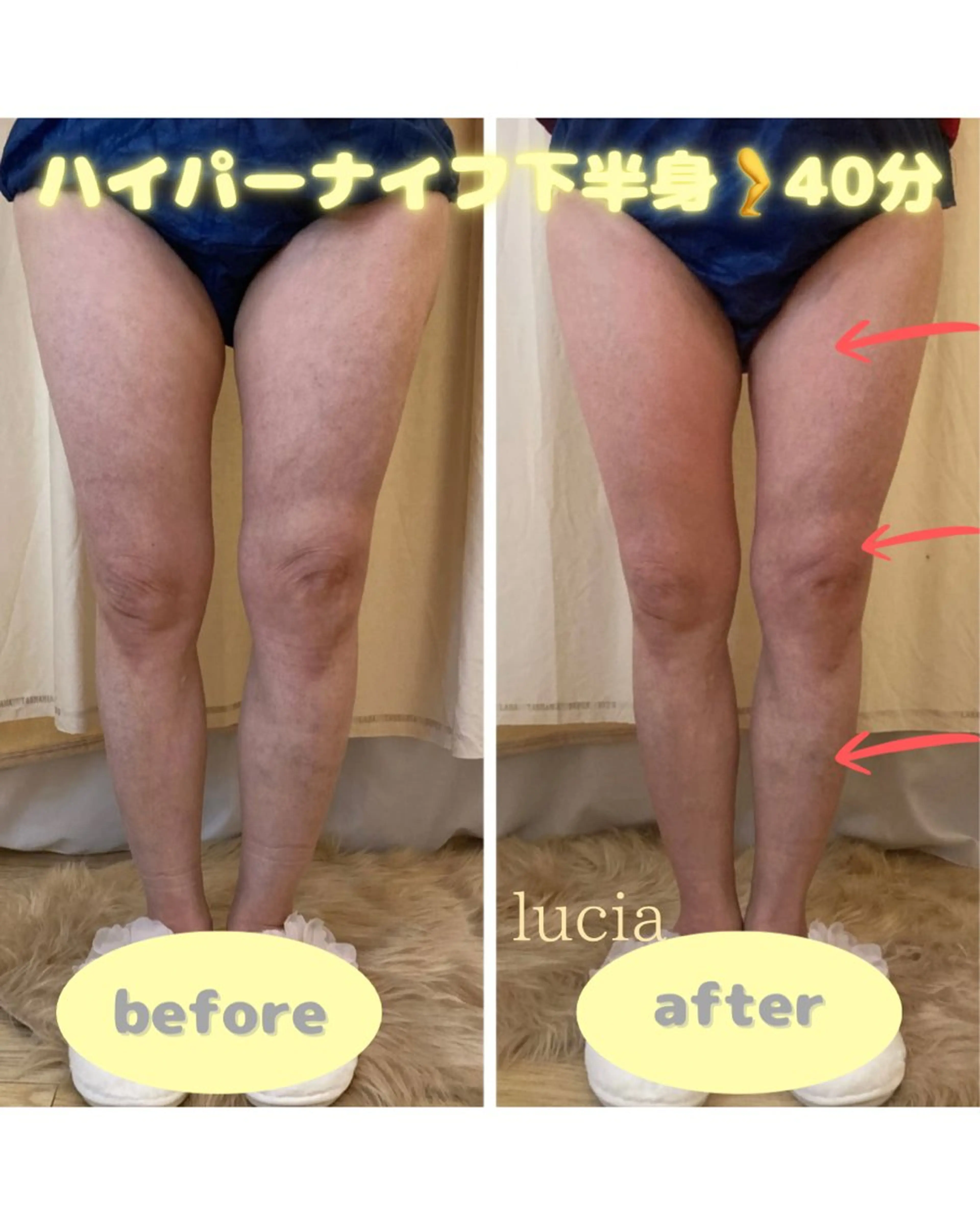 lucia  豊明 肌管理のエステ・リラクイメージ