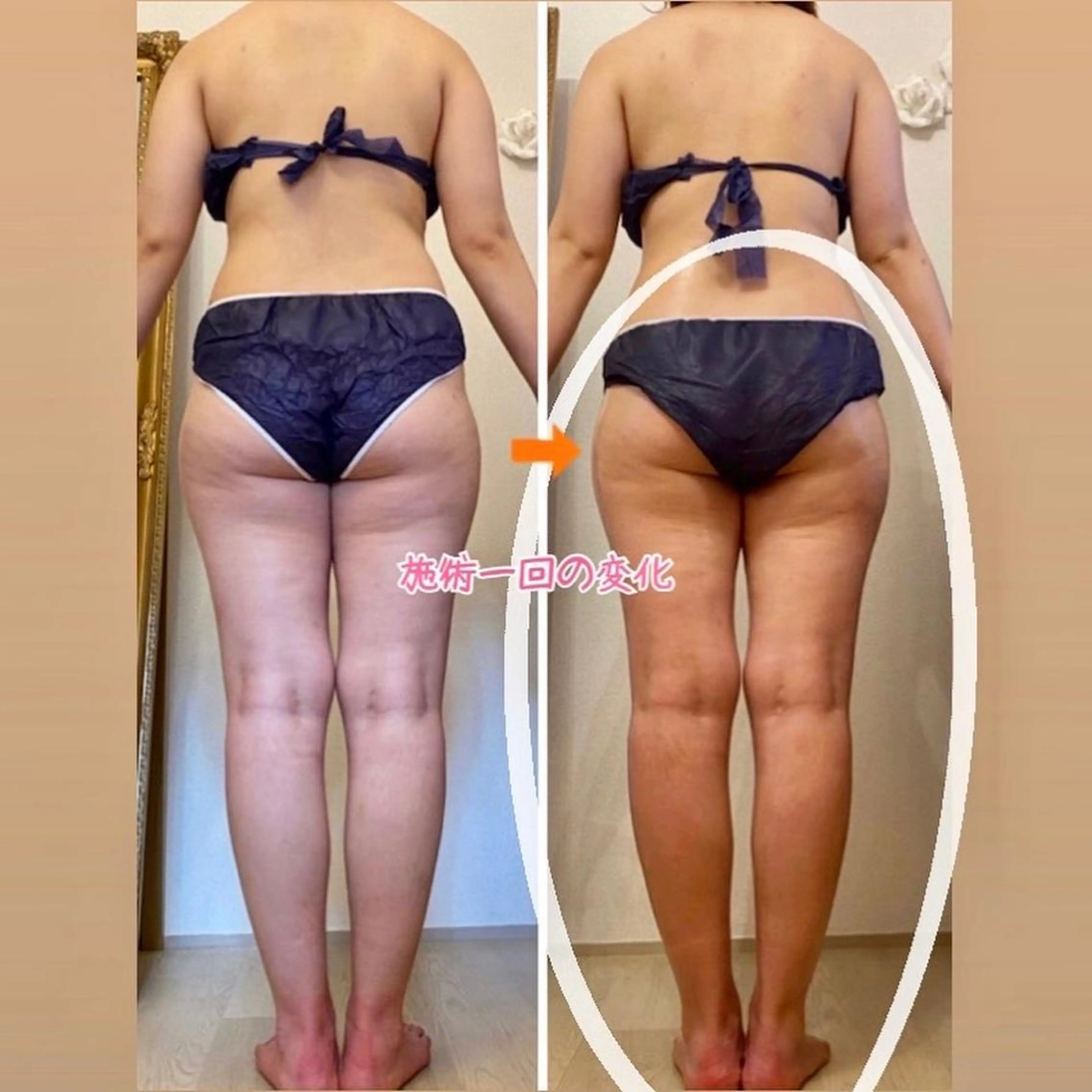 ショート カラー パーマ ヘアアレンジ メンズ キッズ ネイル マツエク・マツパ アイブロウ ‍痩身＆ボディ 結果出し🌟丹野のエステ・リラクイメージ