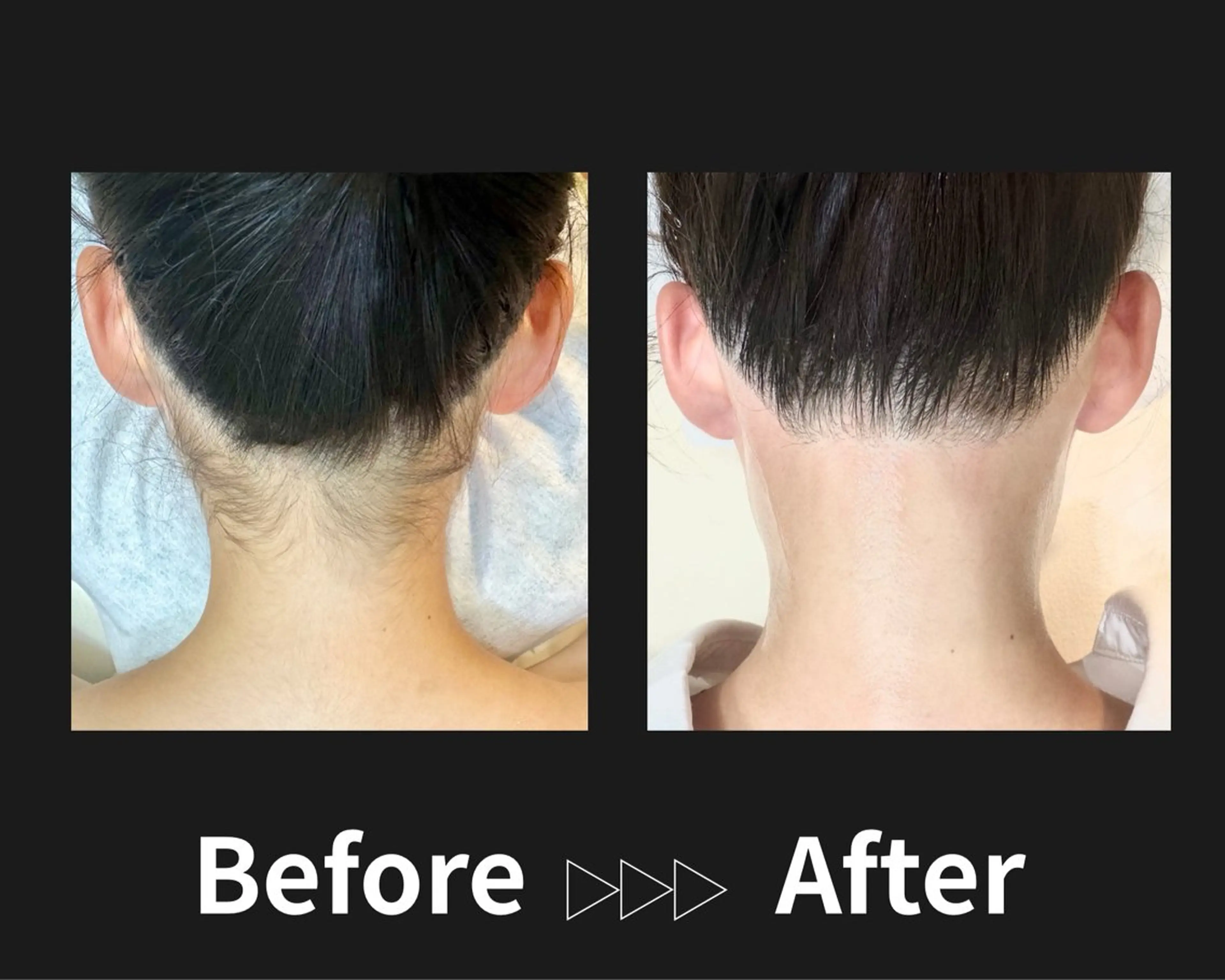 脱毛サロン FIS　溝の口店のエステ・リラクイメージ