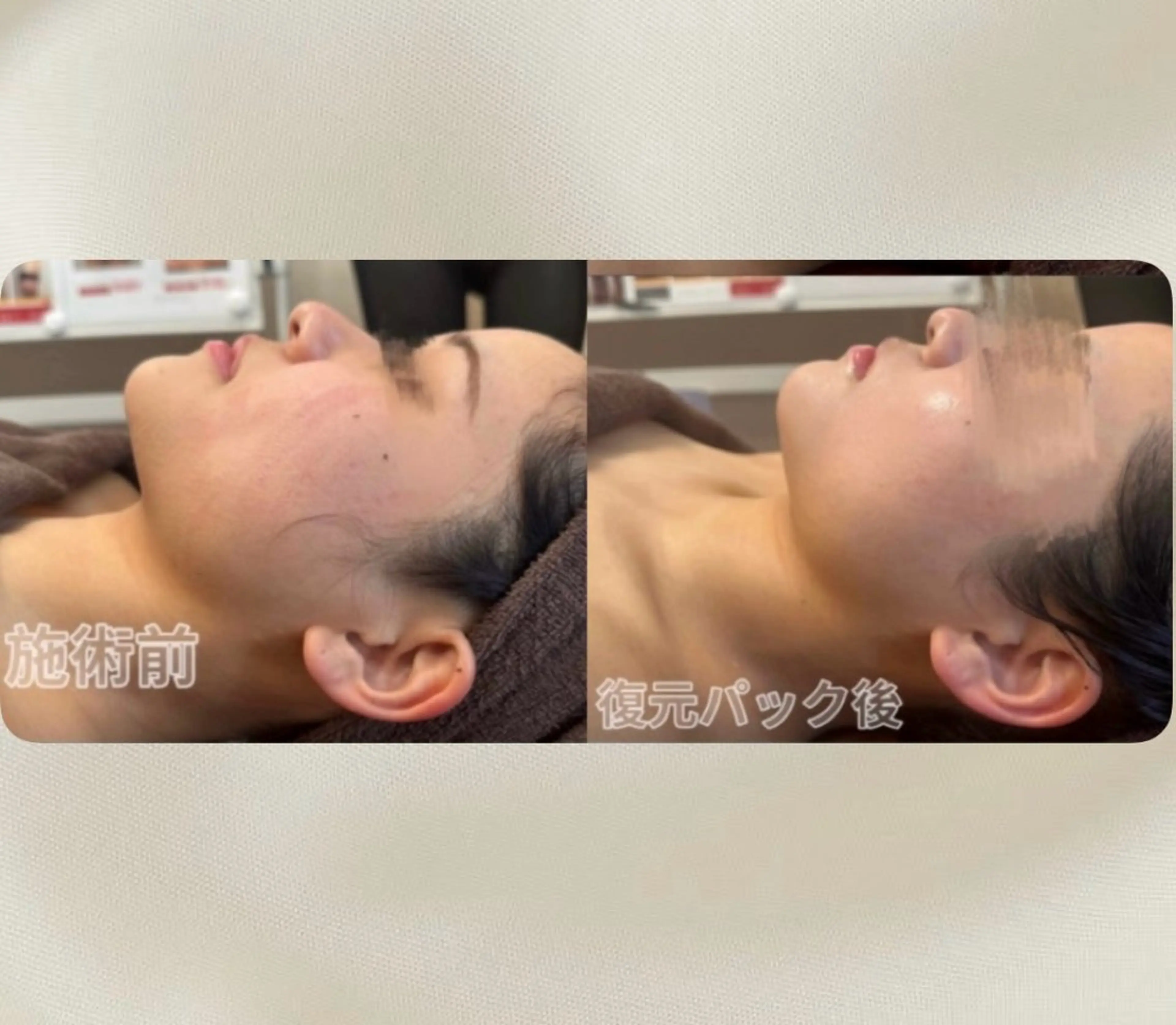 エステ 浮腫|肩こり|張り 日々の疲れを解消★のエステ・リラクイメージ