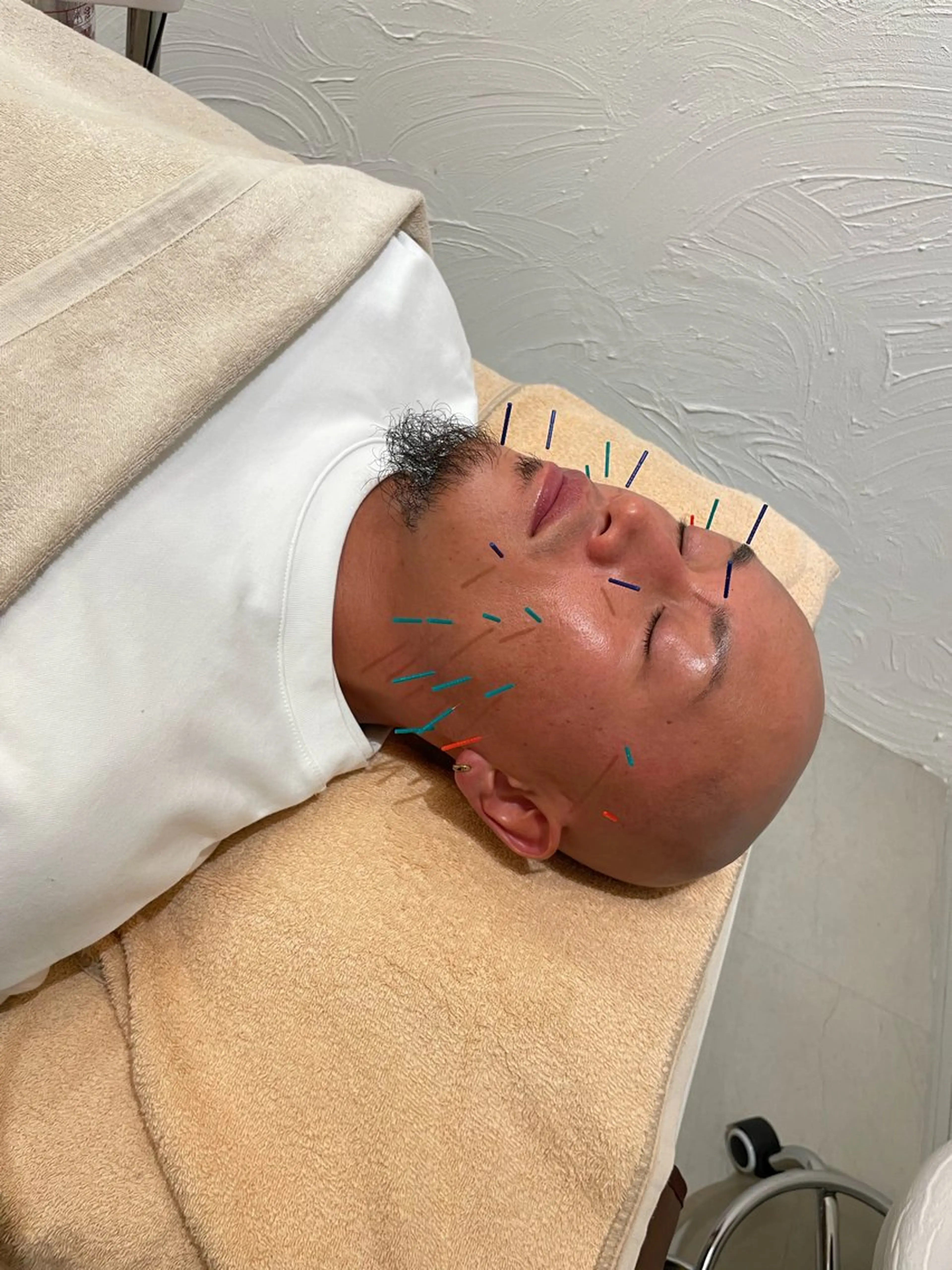 美容鍼サロンメゾンブランシェ所属・🌸美容鍼サロン🌸 メゾンブランシェ🌈のエステ・リラクイメージ