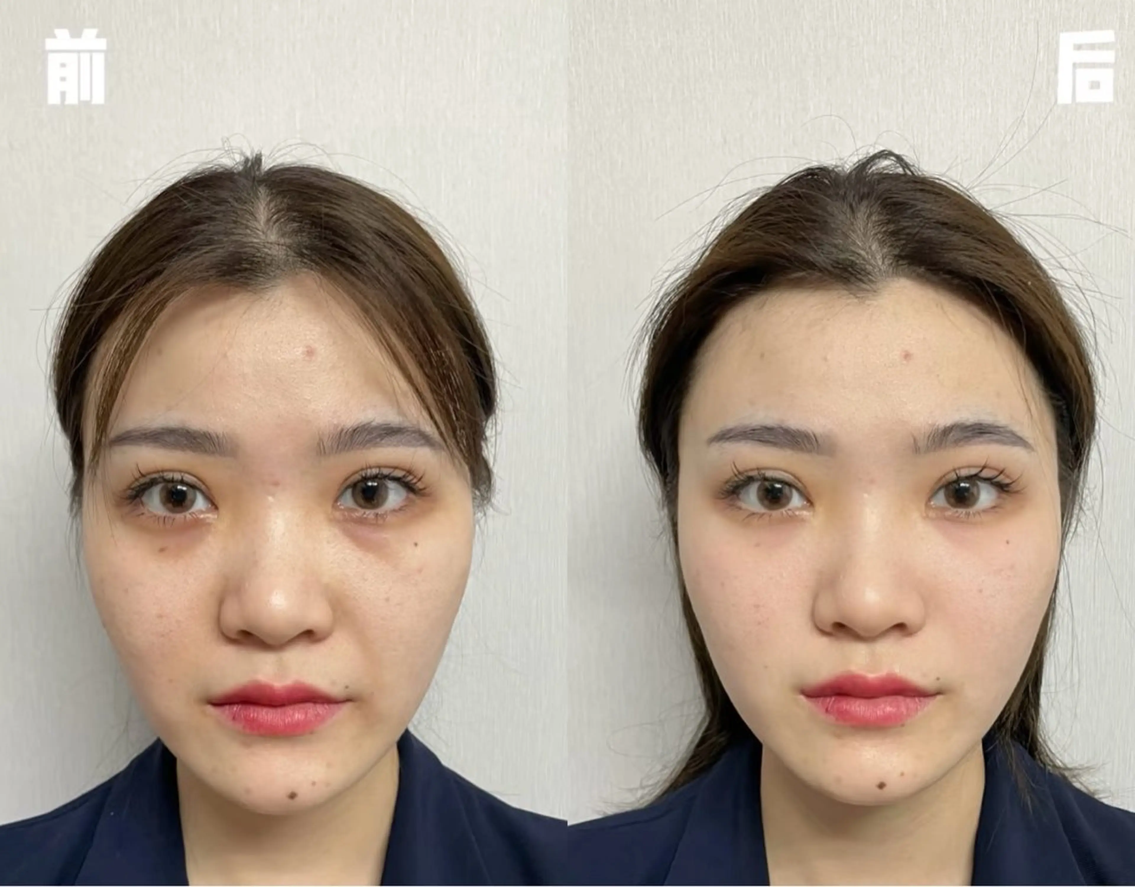 ネイル エステ aliaハイフ&水光ジェットサロン所属・aliaハーブ水光店 エステティシャン募集のエステ・リラクイメージ