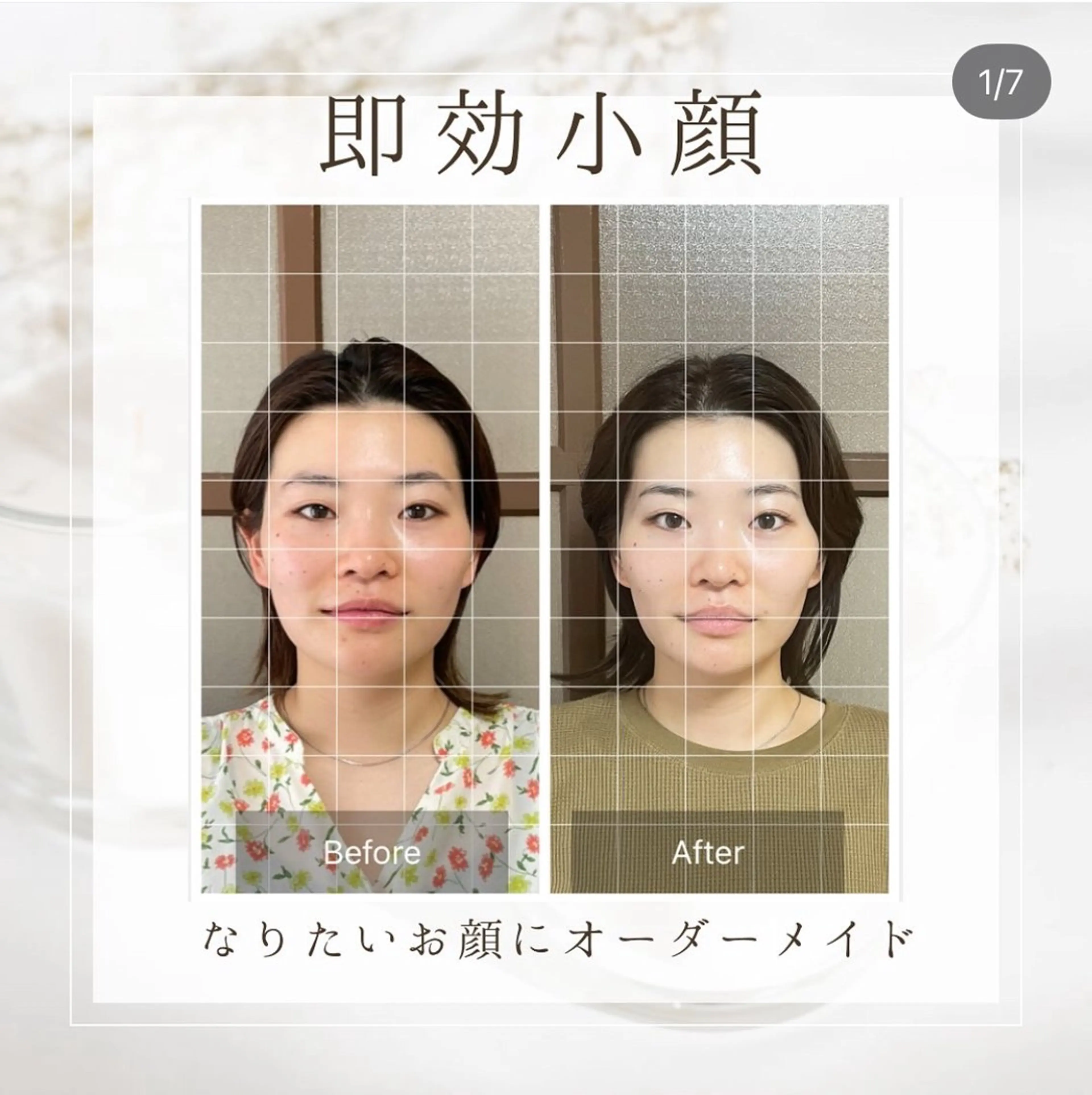 速攻小顔オーダーメイド100分の写真