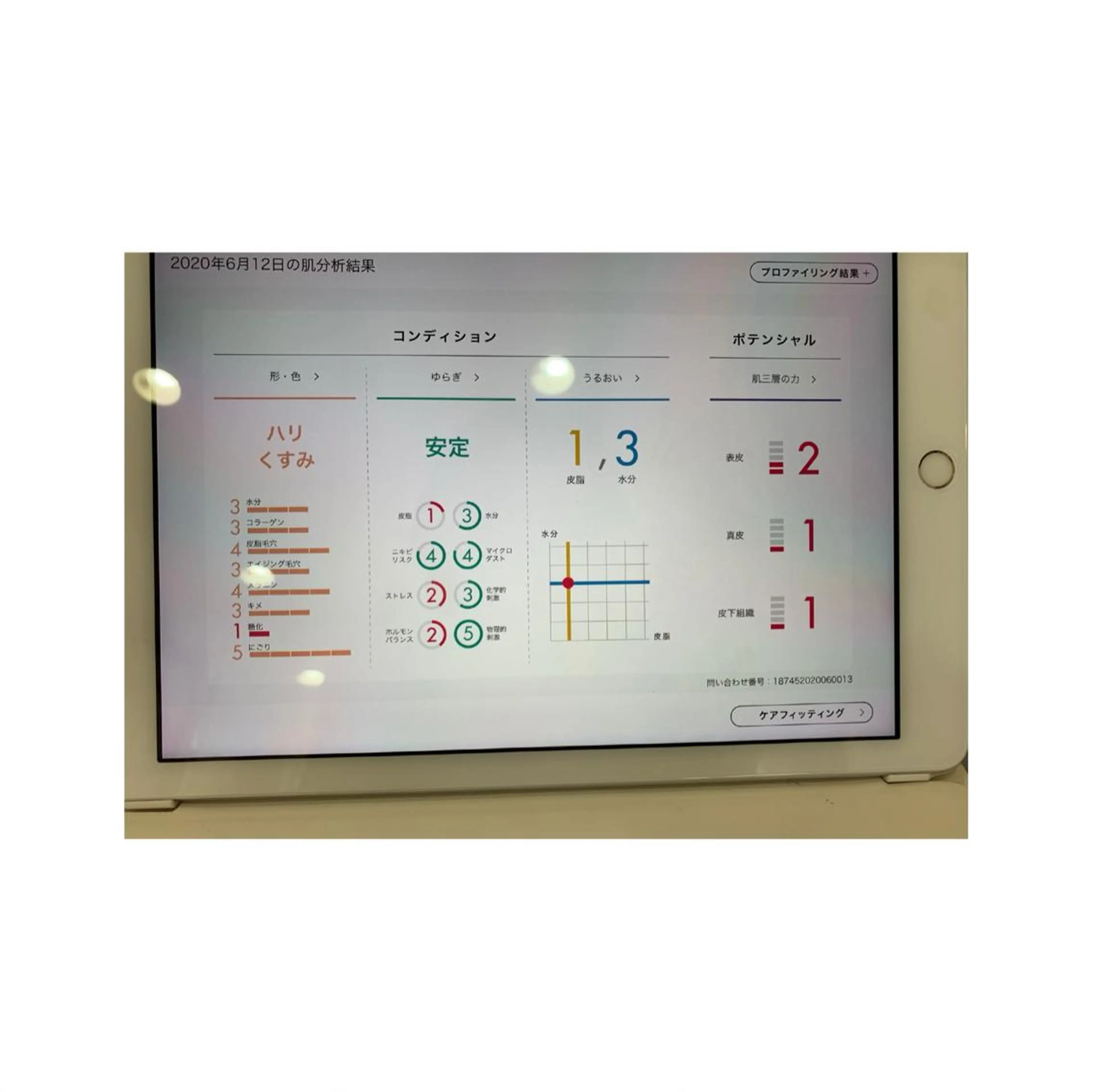 POLAクリスタルアンジュ所属・POLA御器所店 かわいれなのエステ・リラクイメージ