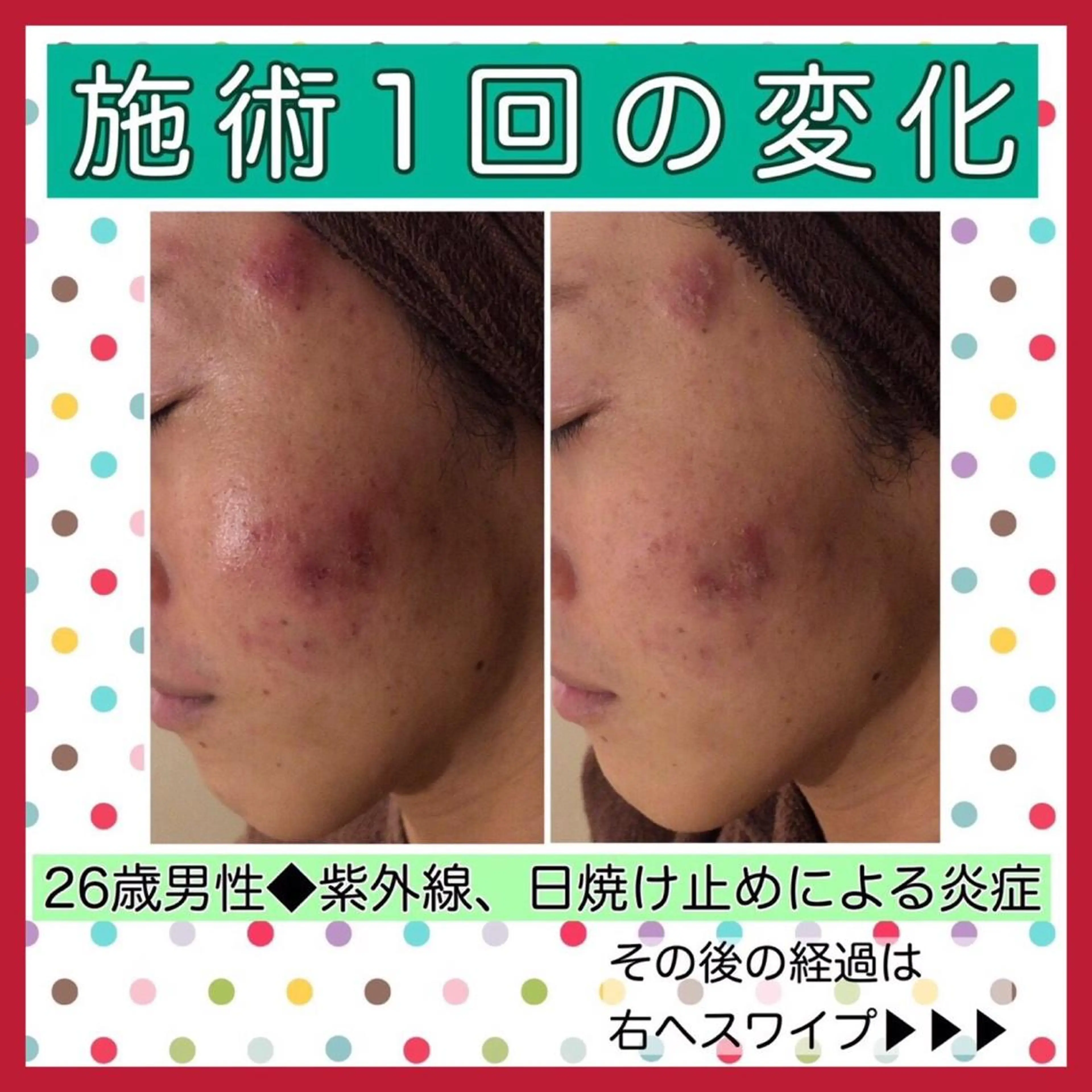 ミディアム カラー パーマ ヘアアレンジ メンズ キッズ ネイル マツエク・マツパ ニキビ・肌質改善専門 ♡人生が変わるサロンのエステ・リラクイメージ