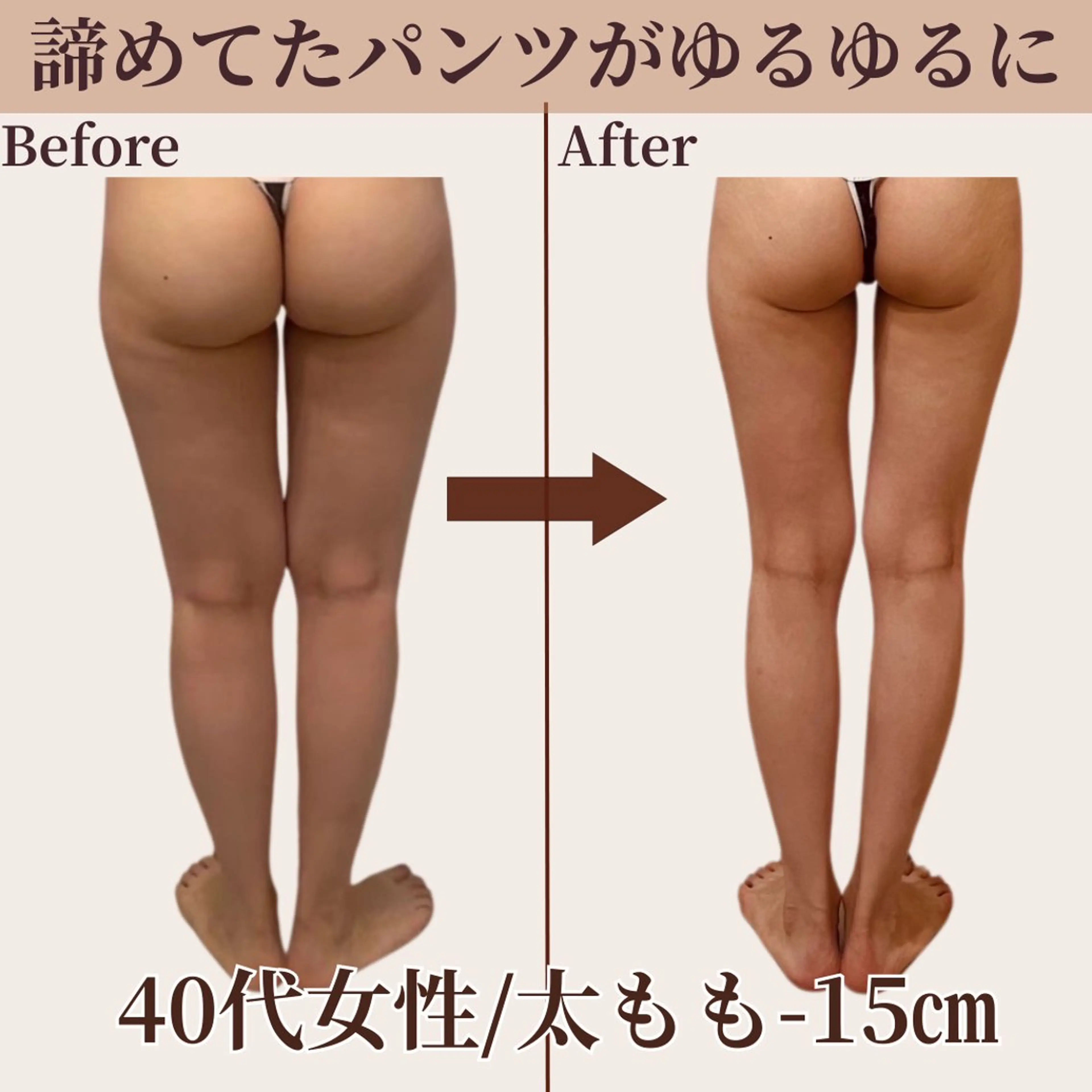 【下半身☆痩身】諦めてたパンツがゆるゆるに♪下半身太り解消◎痩せない太もも/お尻/前ハリ/横ハリ《初回限定💫特別価格》の写真