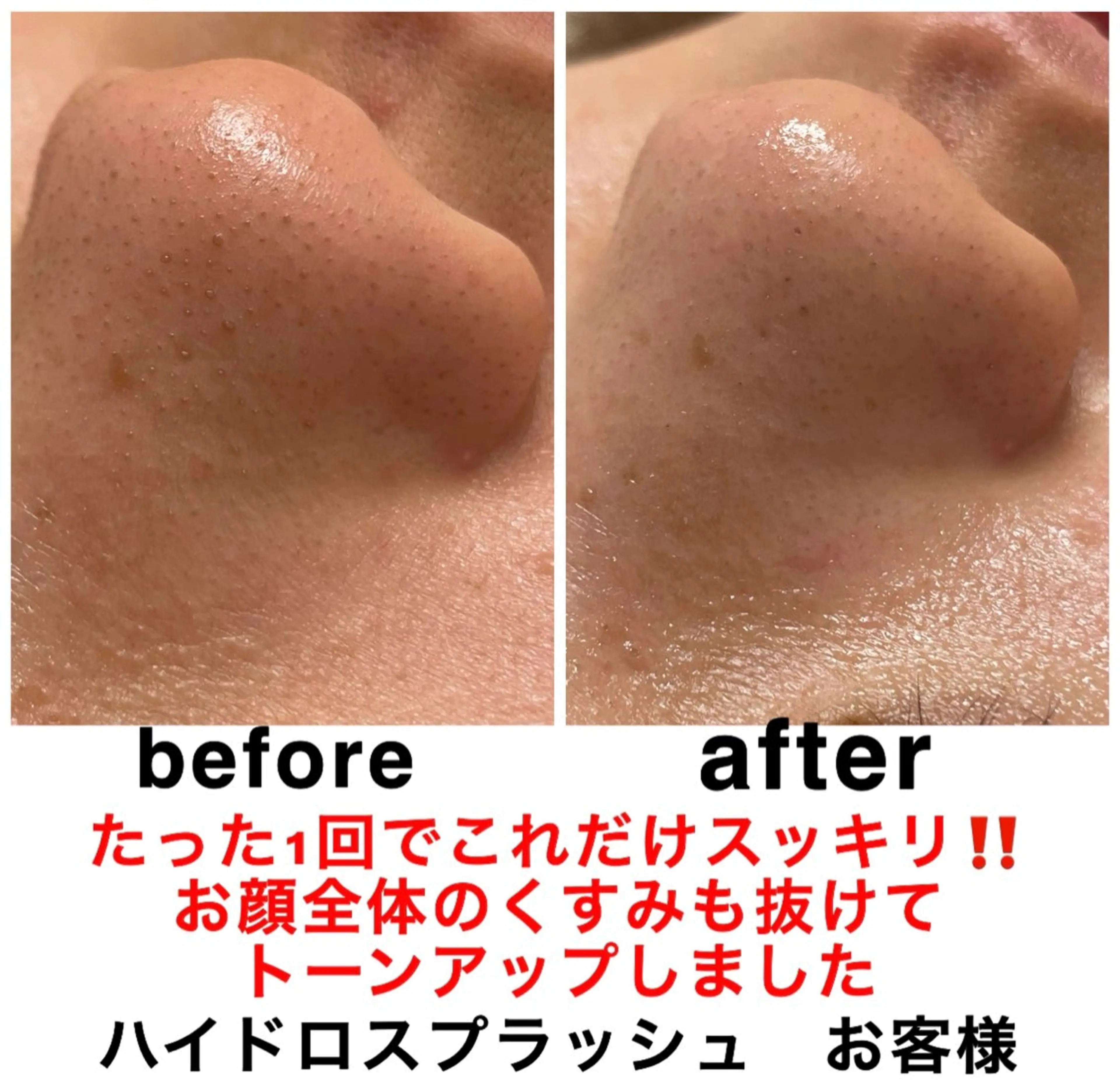 エステ リラク ネイル・エステサロン UILANIのネイルデザイン