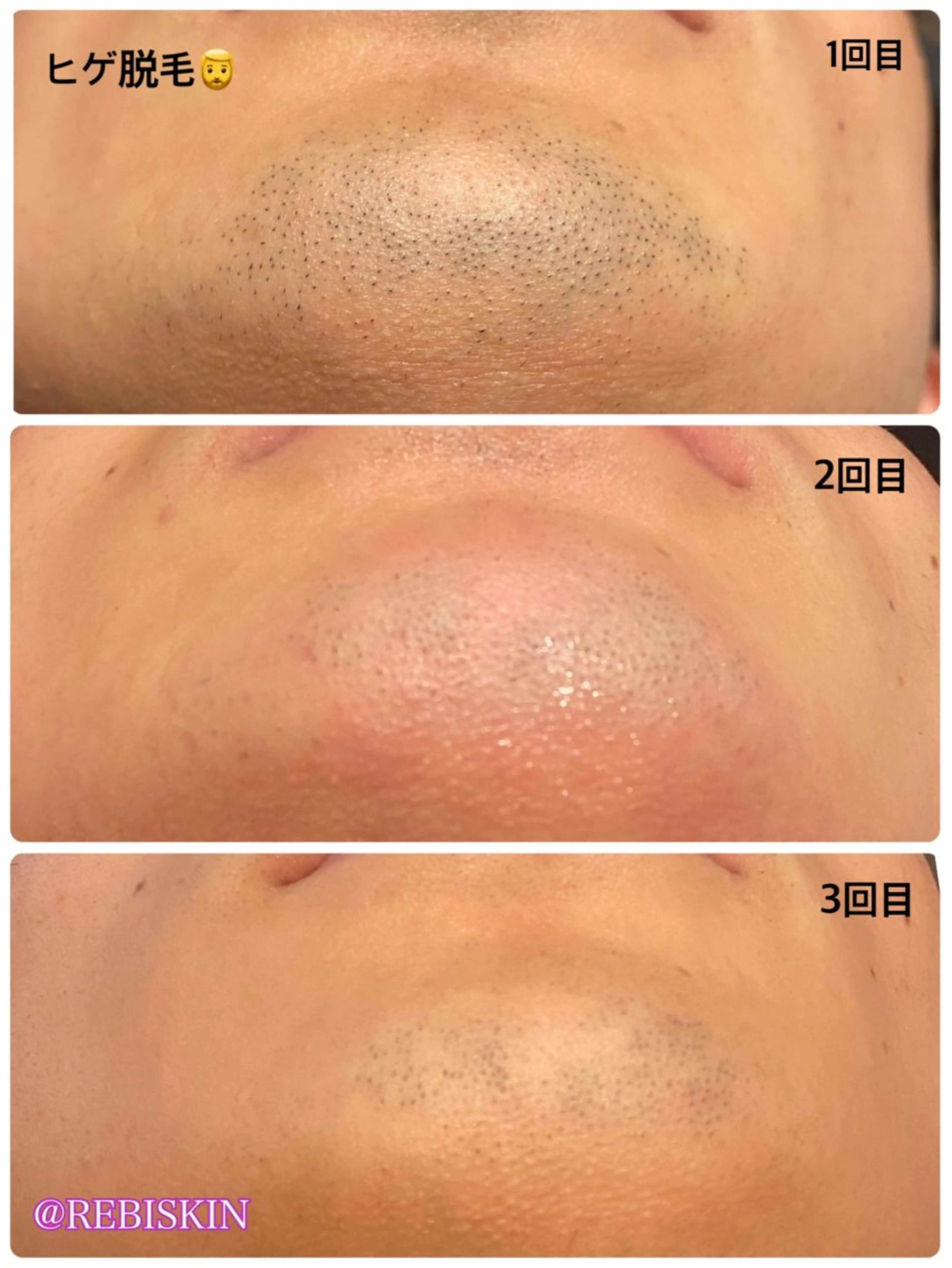 冷えむくみ改善専門 REBISKIN🌿のエステ・リラクイメージ