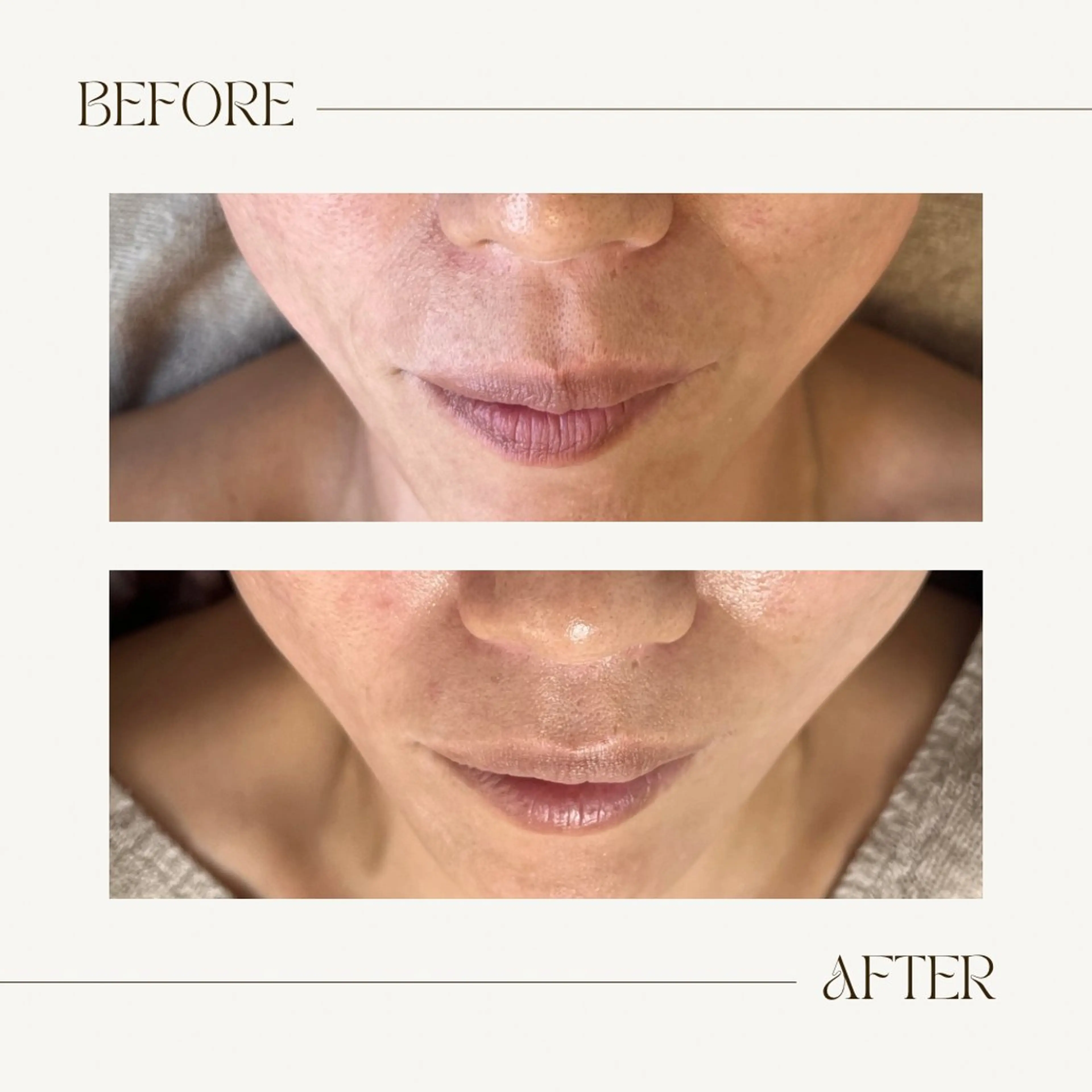 1st｜フェイシャル エステ専門店のエステ・リラクイメージ