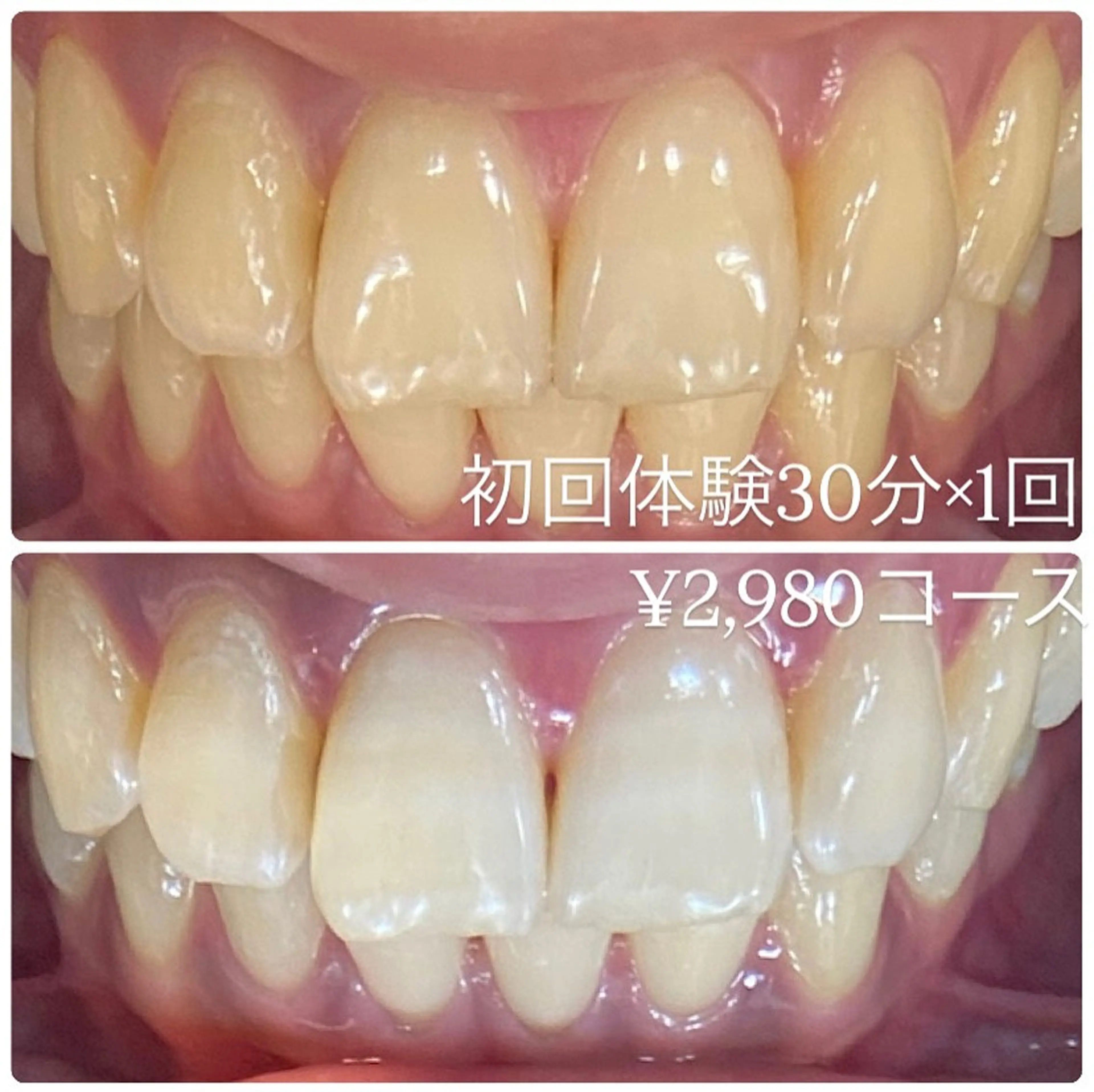 ホワイトニングルーム 横浜店のその他イメージ